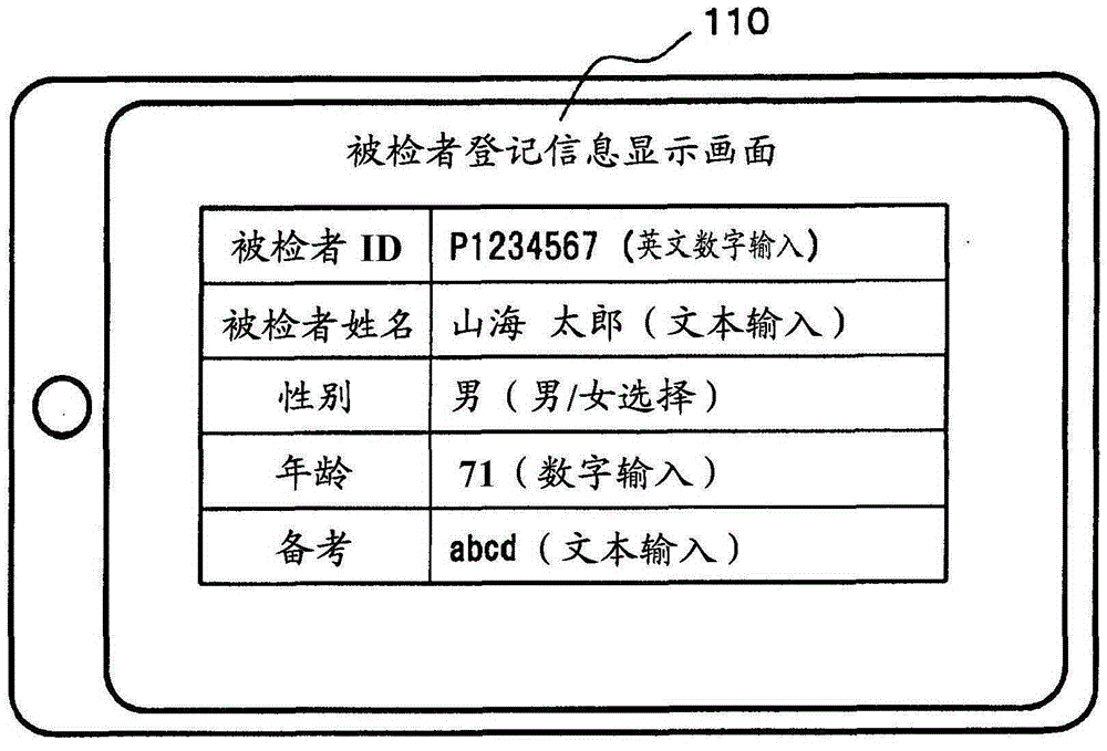 Brain dysfunction assessment method, brain dysfunction assessment device, and program thereof