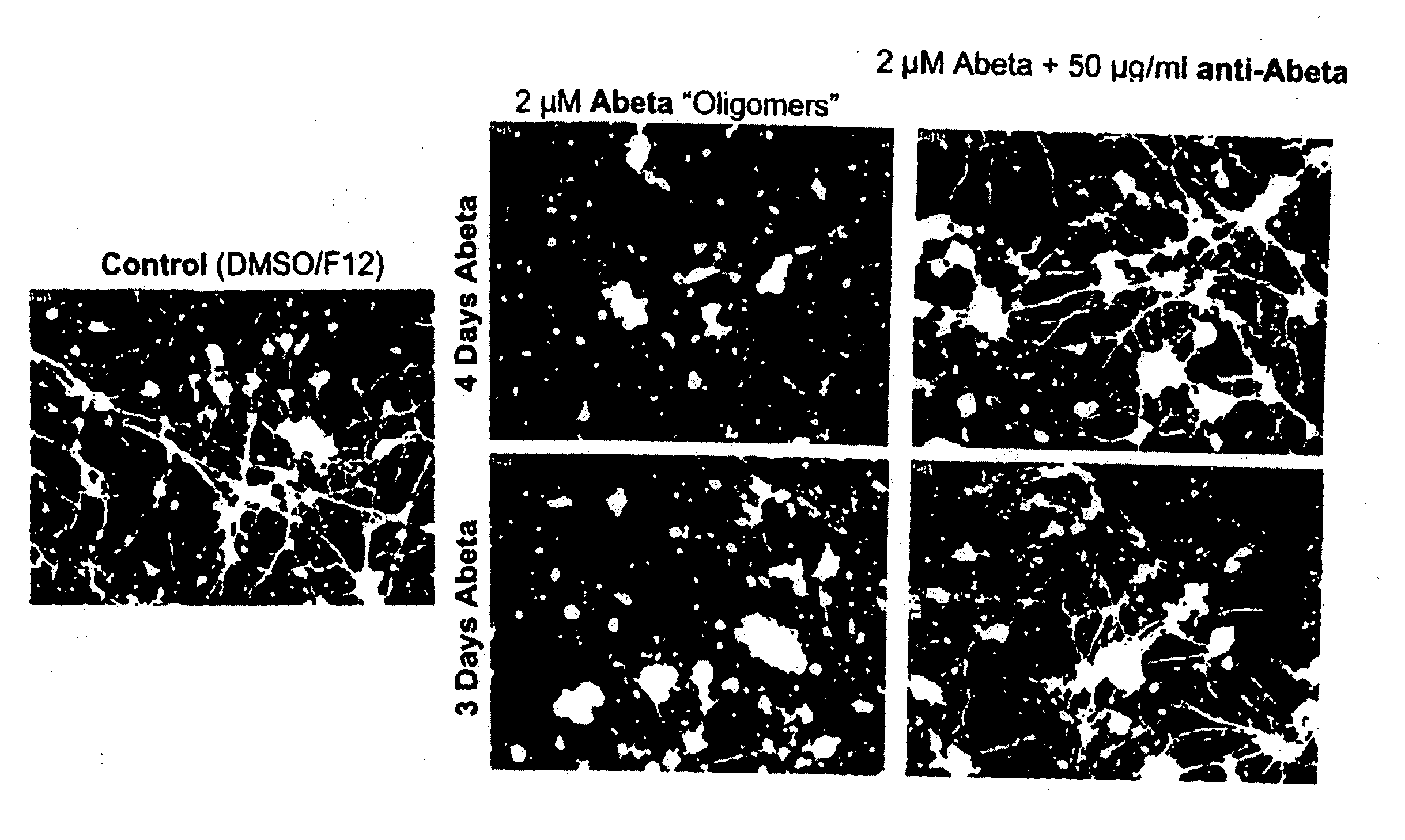 Humanized antibody igg1