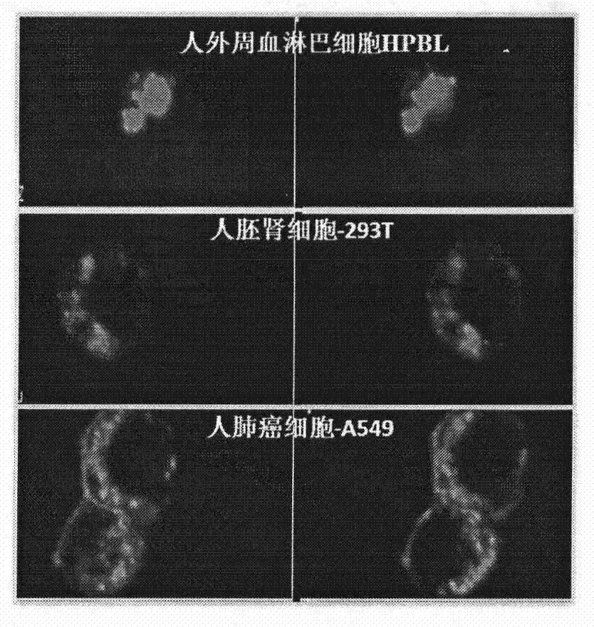 Preparation and use of recombinant gold needle mushroom immunomodulatory protein