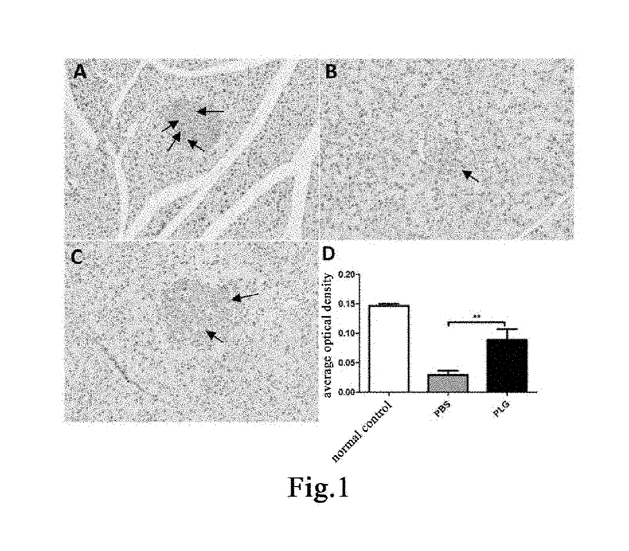 Method for promoting expression of insulin receptor substrate-2