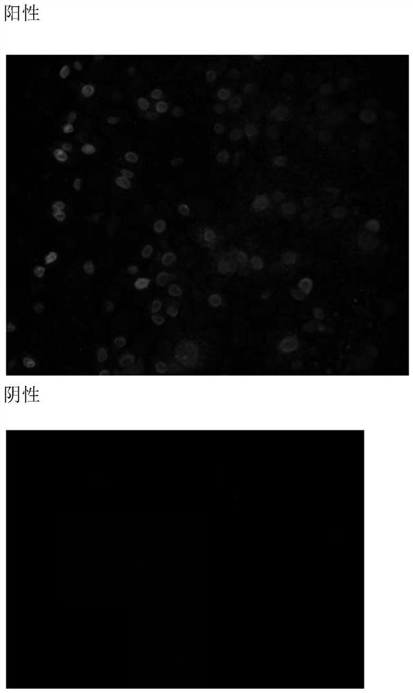 A porcine circovirus type 3 virus strain and its application