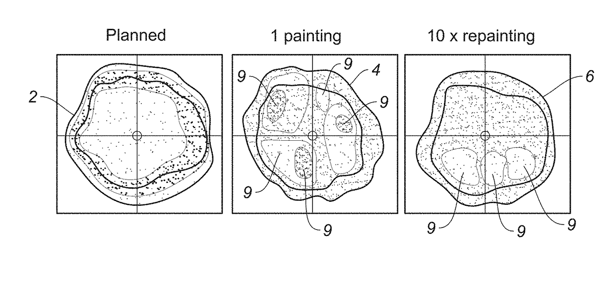 Mitigation of interplay effect in particle radiation therapy