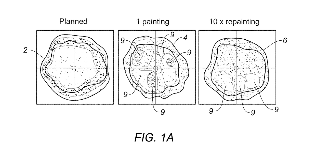 Mitigation of interplay effect in particle radiation therapy