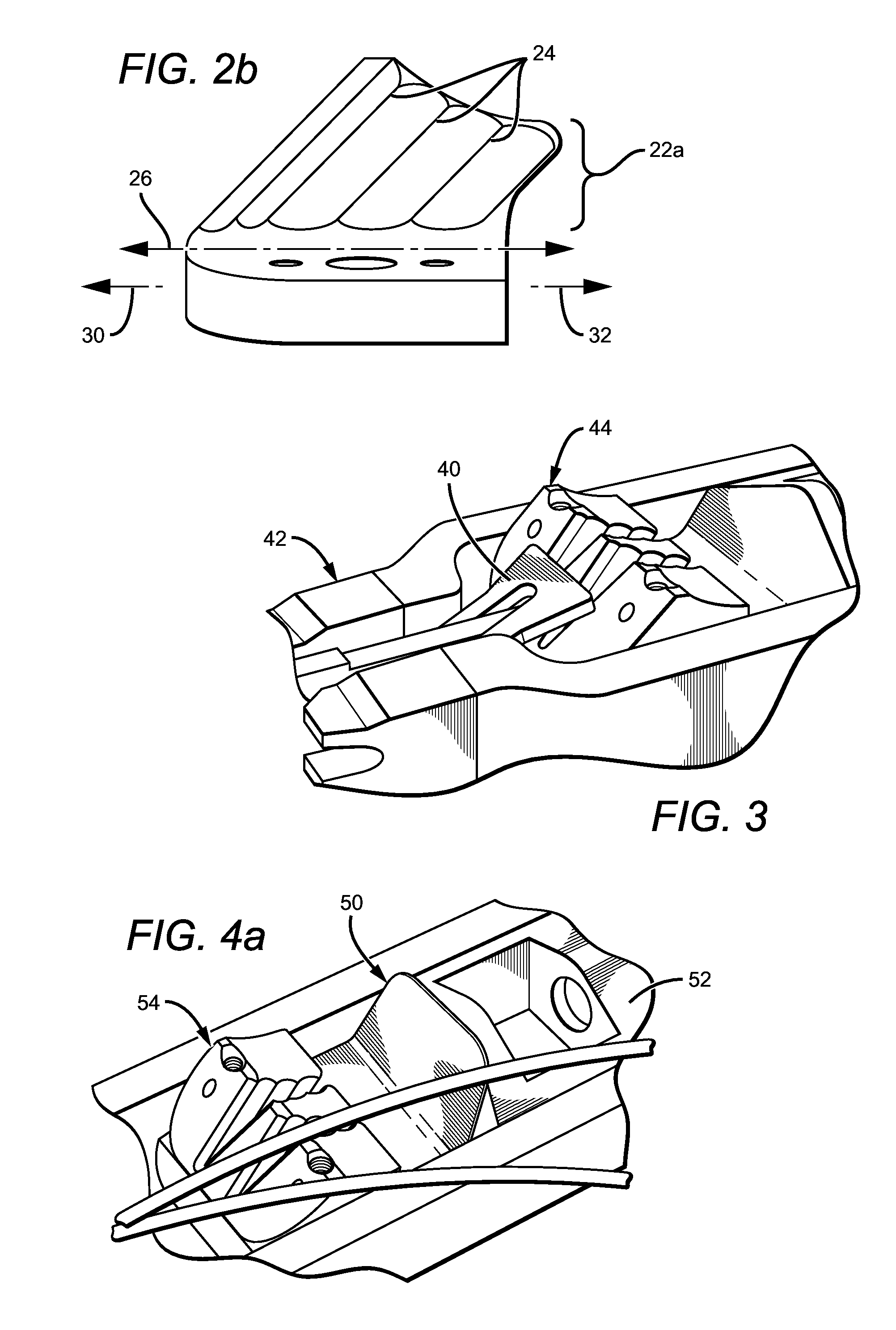 Surgical cable tensioning system