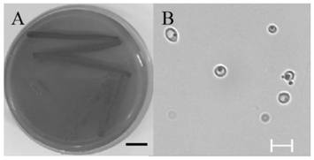 Wickerhamomyces anomalus strain for whole-process green production of fruit wine, and application of wickerhamomyces anomalus strain