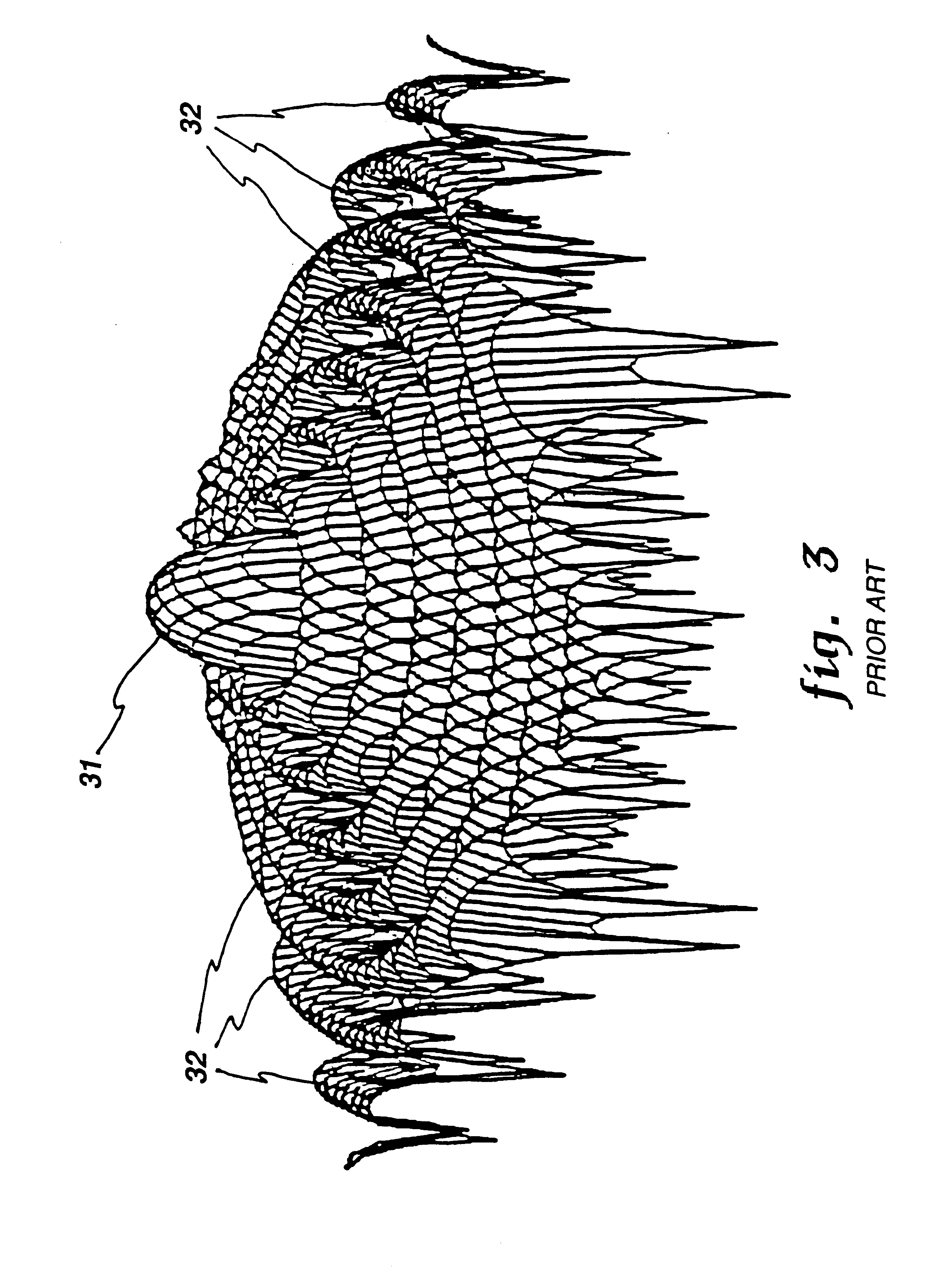 Combining sidelobe canceller and mainlobe canceller for adaptive monopulse radar processing