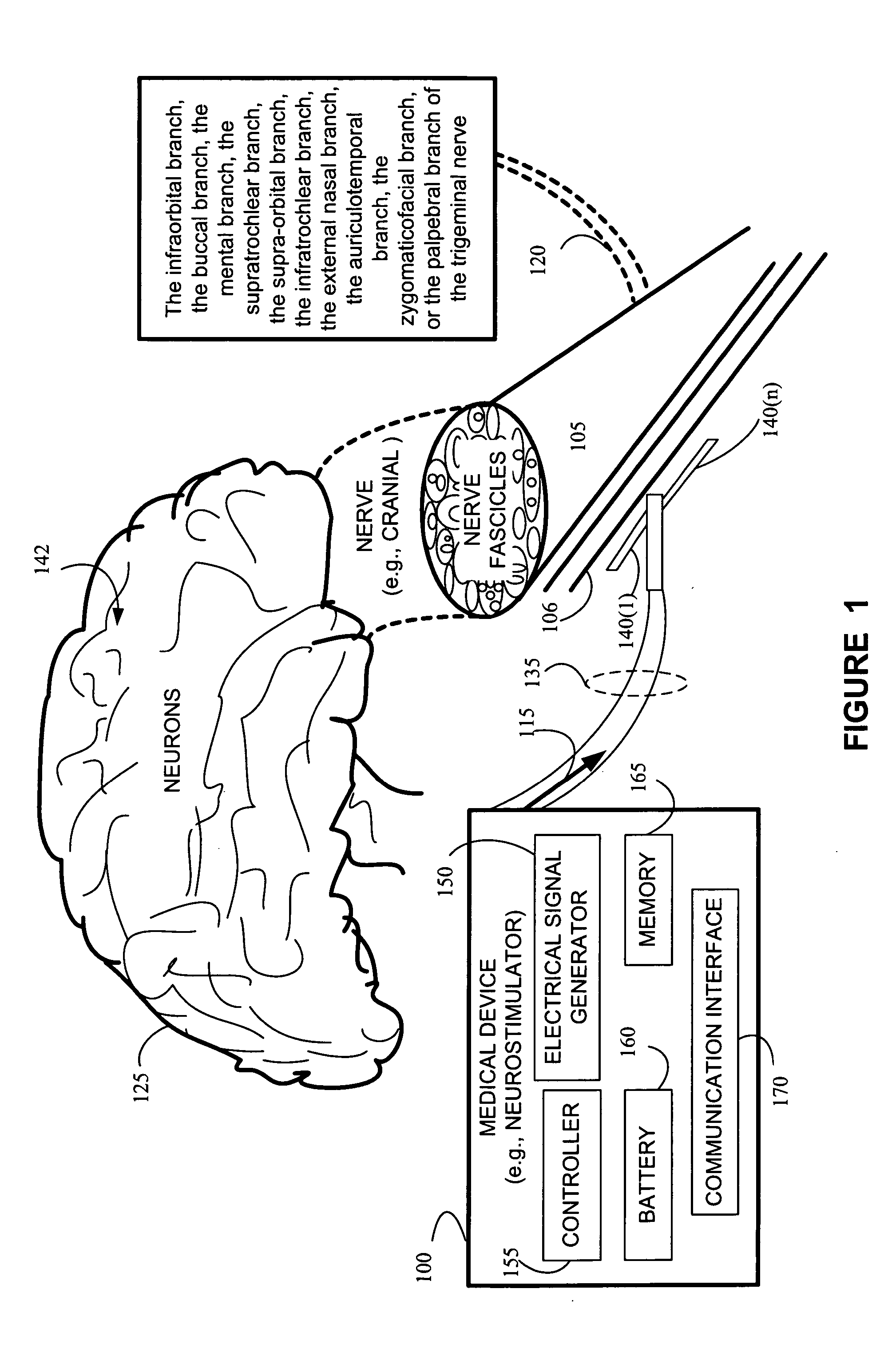 Transcutaneous trigeminal nerve stimulation to treat motion sickness