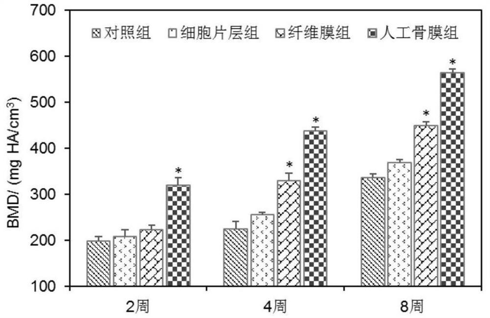 Bionic artificial periosteum with "sandwich" structure and preparation method of bionic artificial periosteum