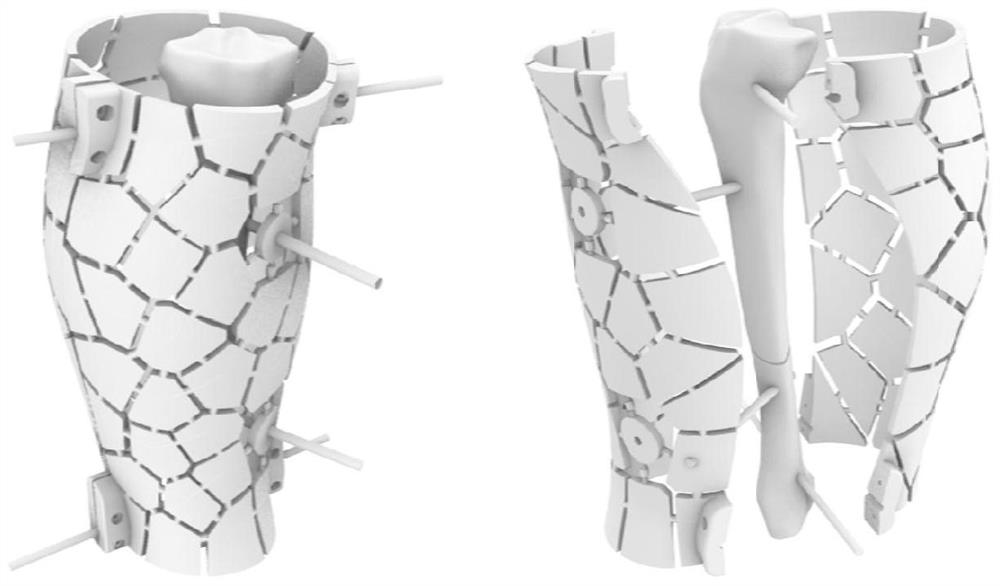 A kind of fracture reduction external fixation device with variable stiffness and its manufacturing method