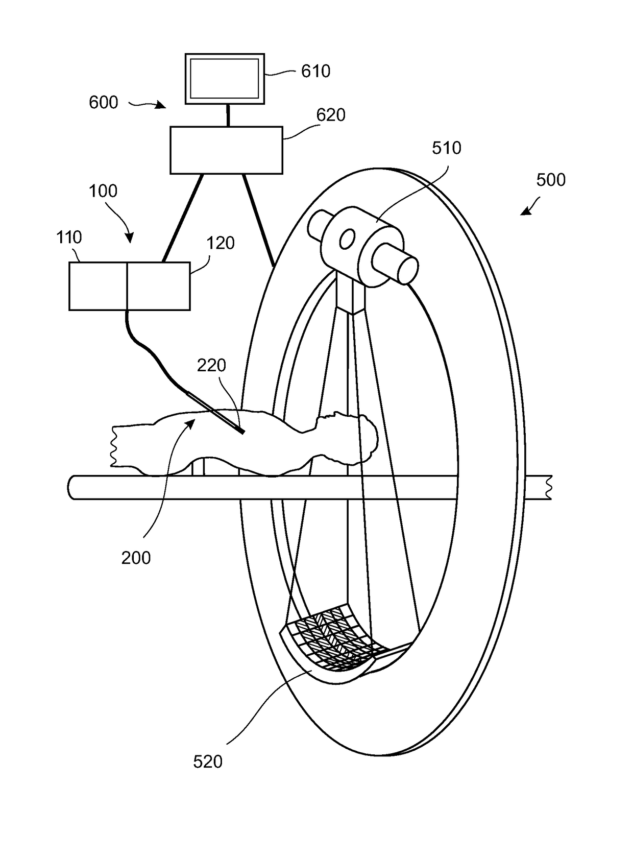 Re-calibration of pre-recorded images during interventions using a needle device