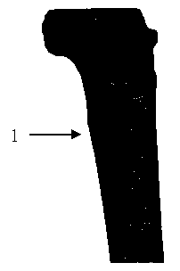 Method for constructing three-dimension finite element model which treats tibial plateau posterior-lateral fracture with different inner fixing manners