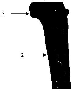 Method for constructing three-dimension finite element model which treats tibial plateau posterior-lateral fracture with different inner fixing manners