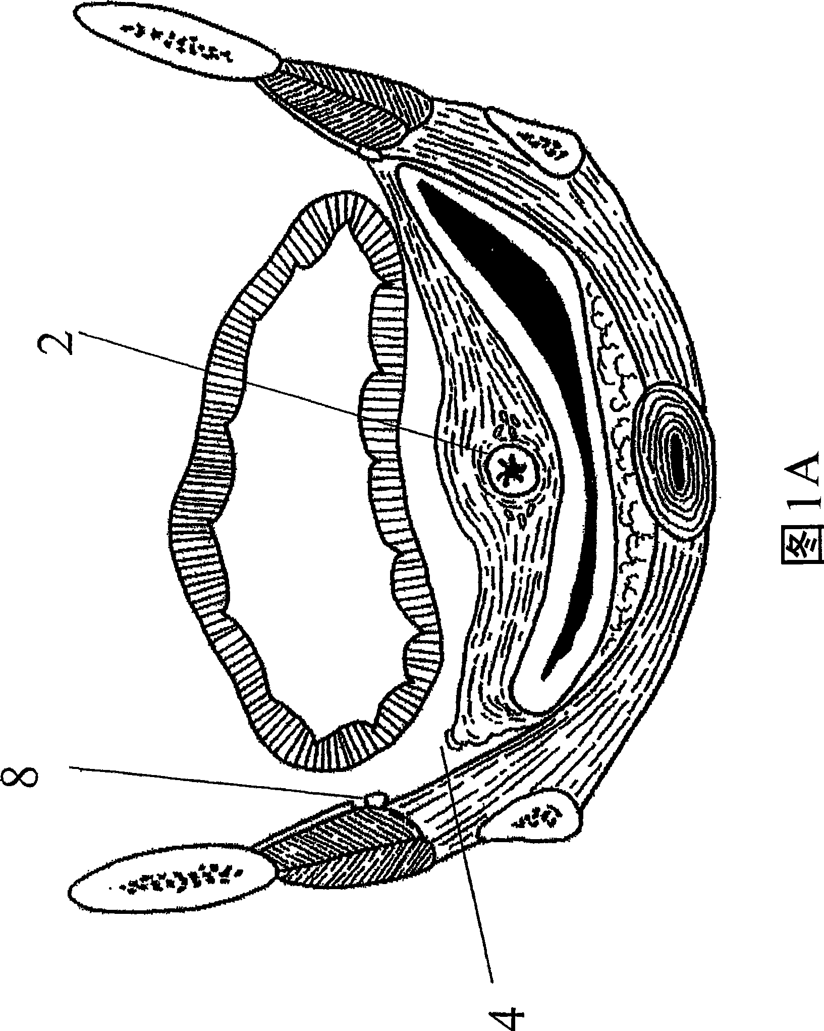 Systems and methods for soft tissue reconstruction