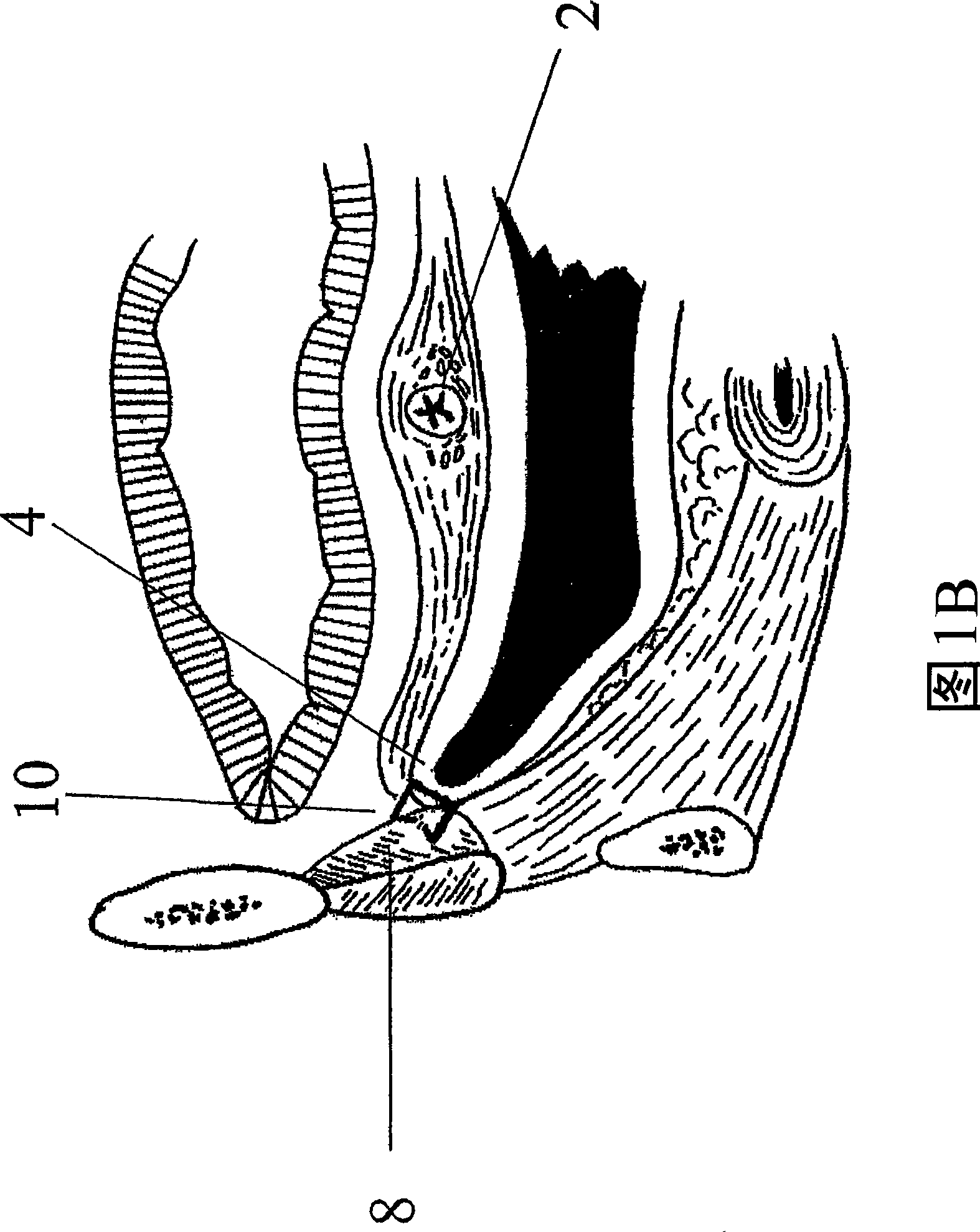 Systems and methods for soft tissue reconstruction