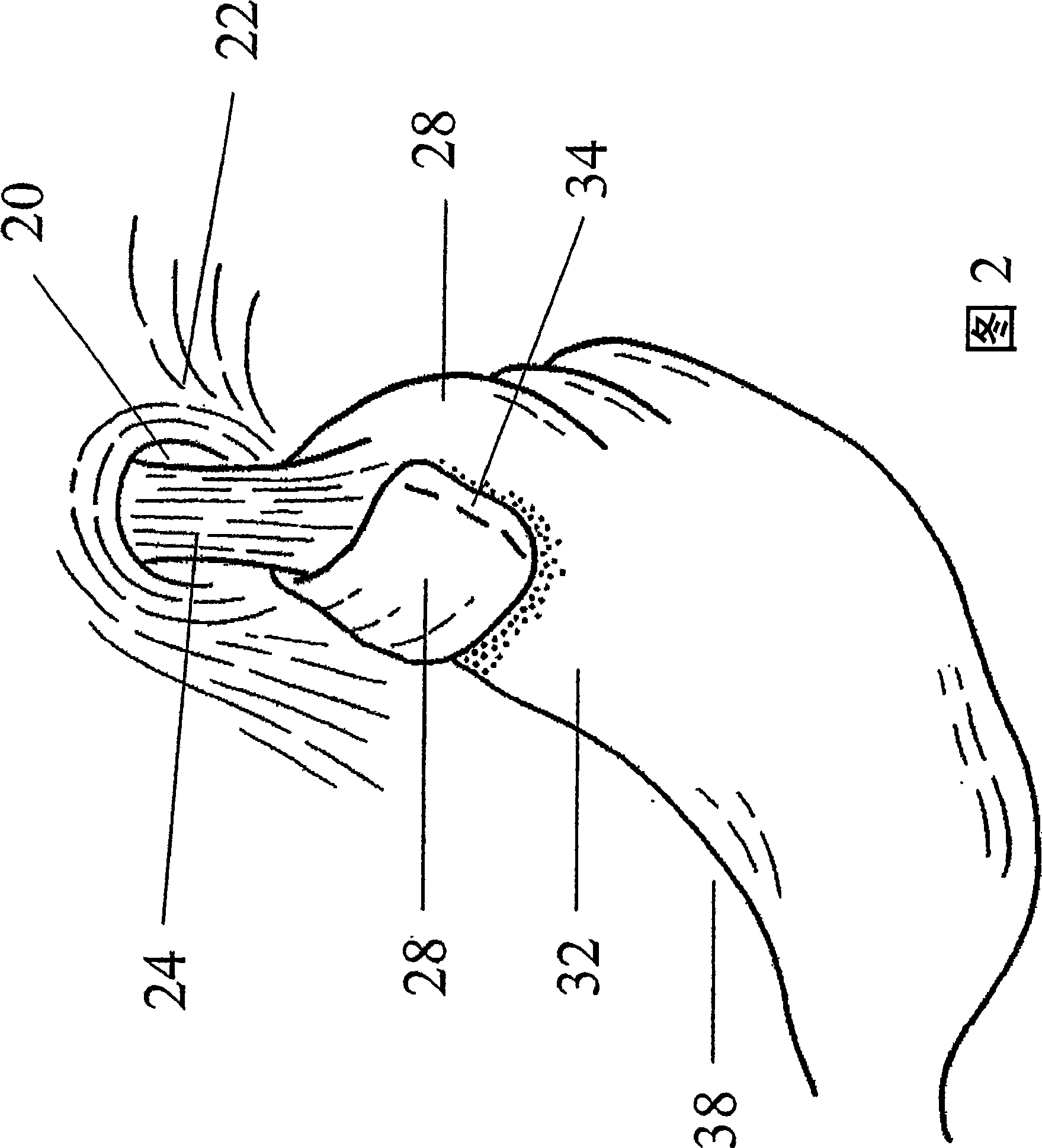 Systems and methods for soft tissue reconstruction