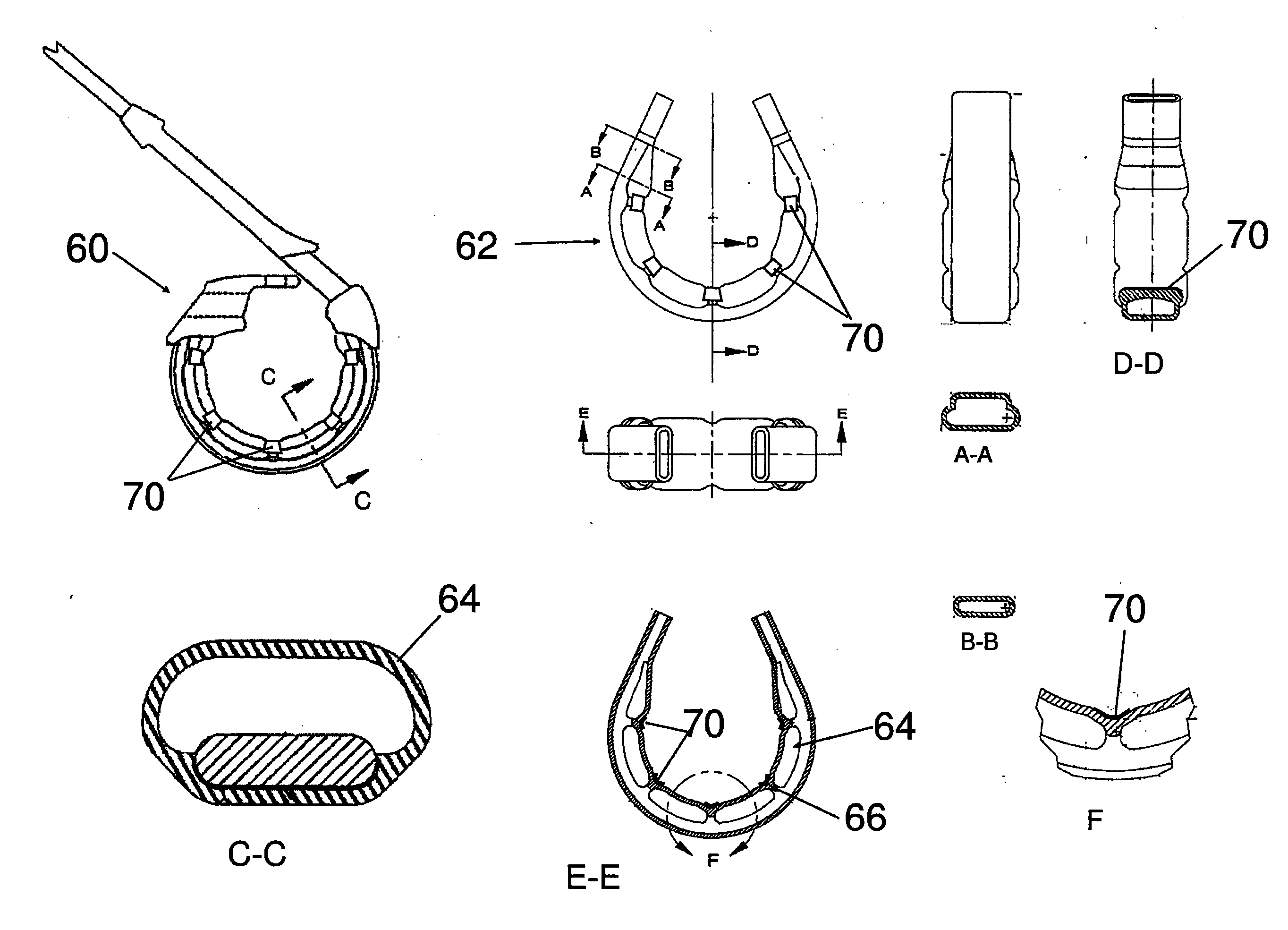 Gastric band with electrical stimulation