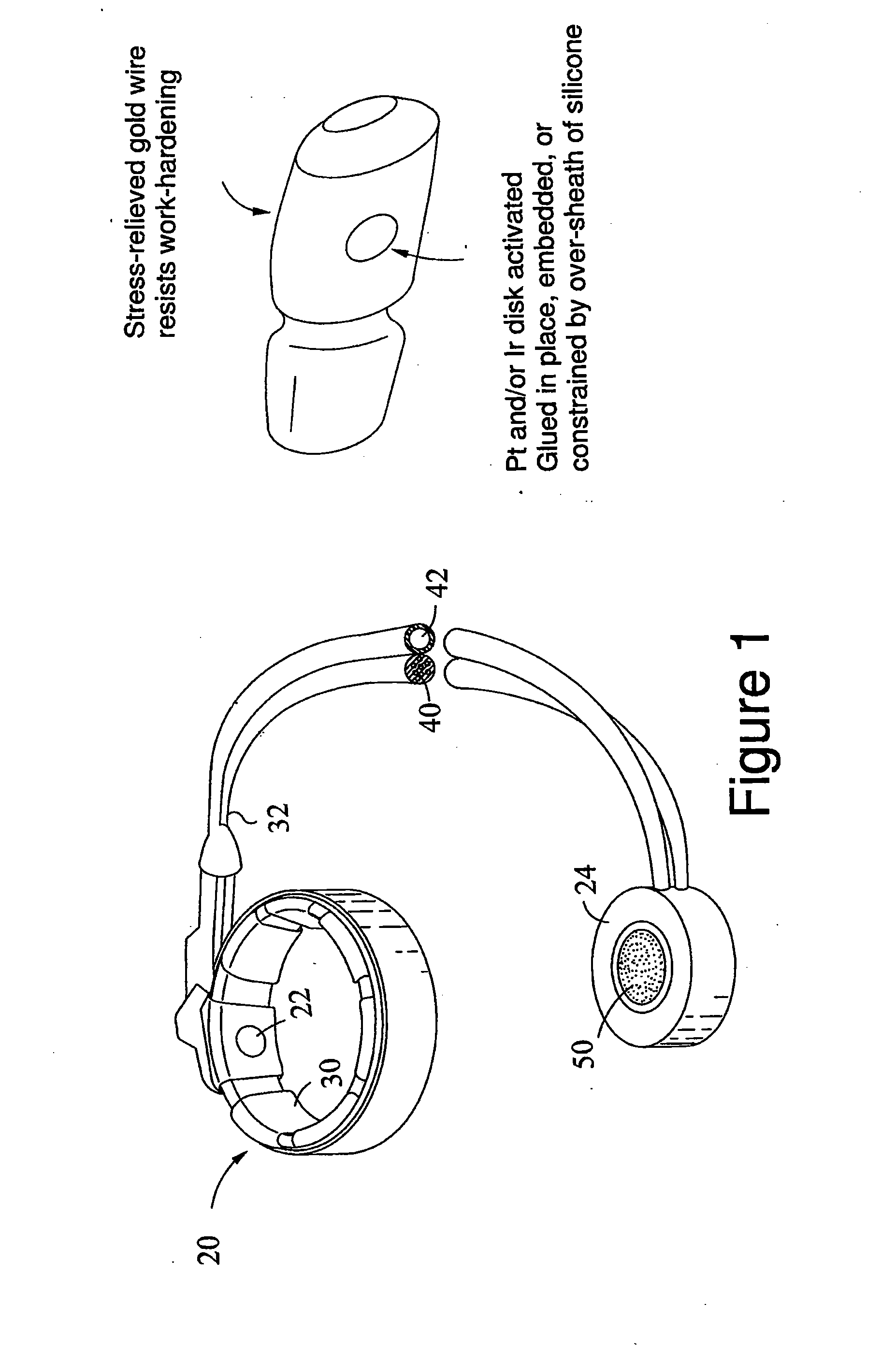 Gastric band with electrical stimulation