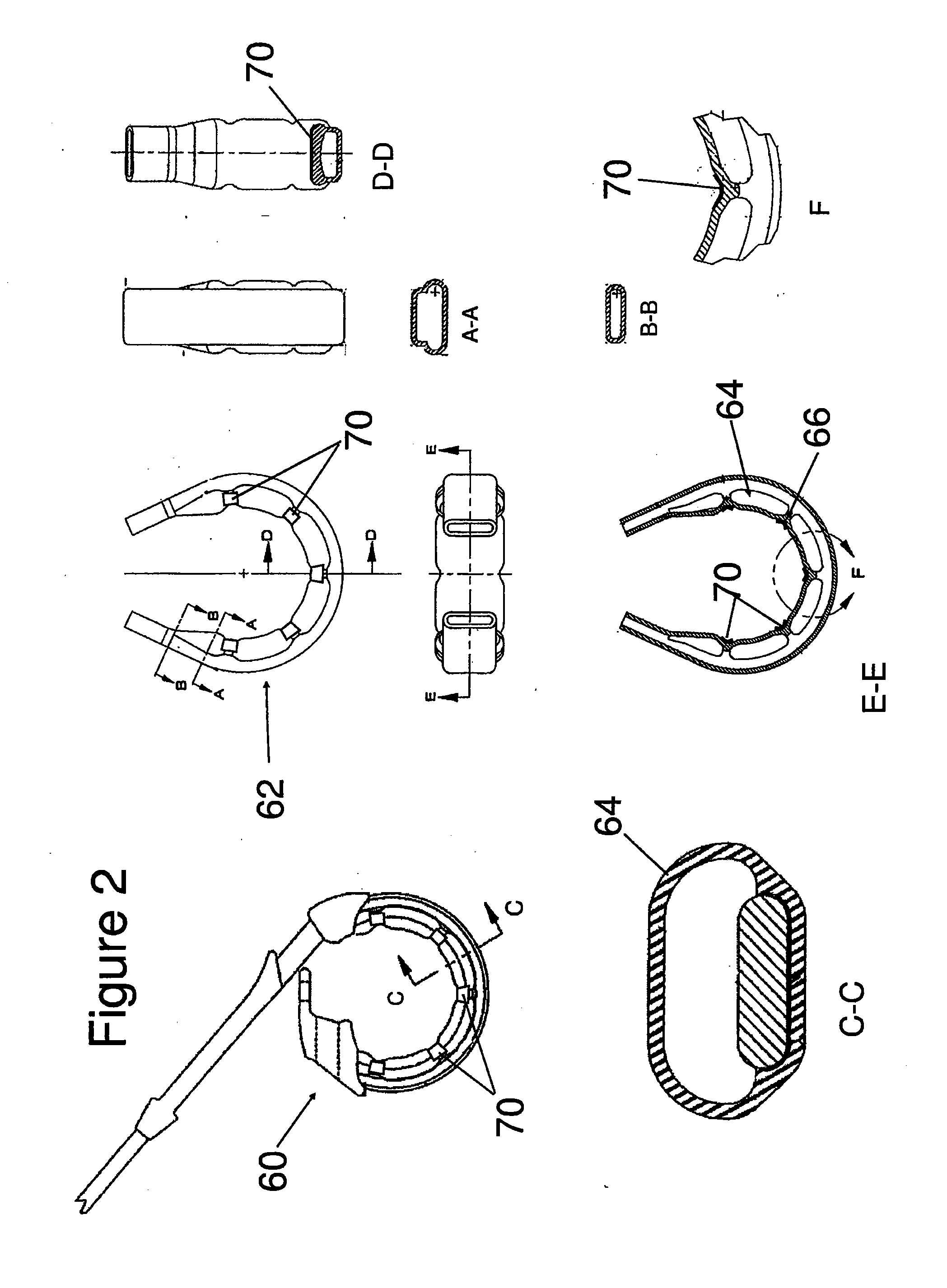 Gastric band with electrical stimulation