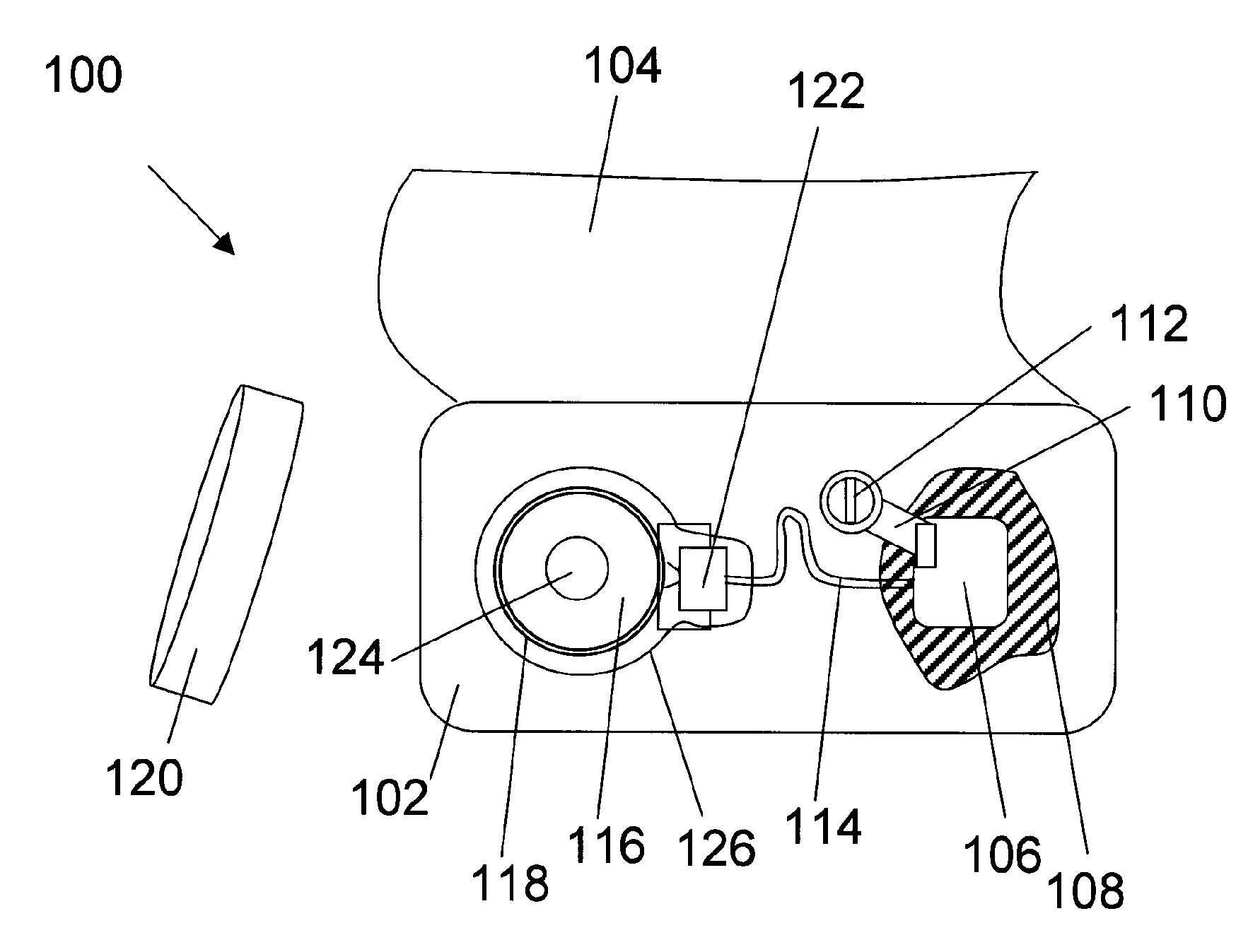 Hearing aid system