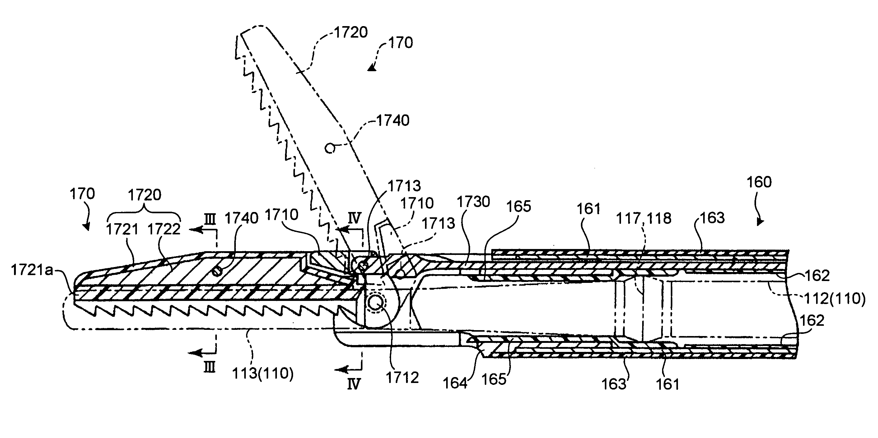 Ultrasonic treatment apparatus