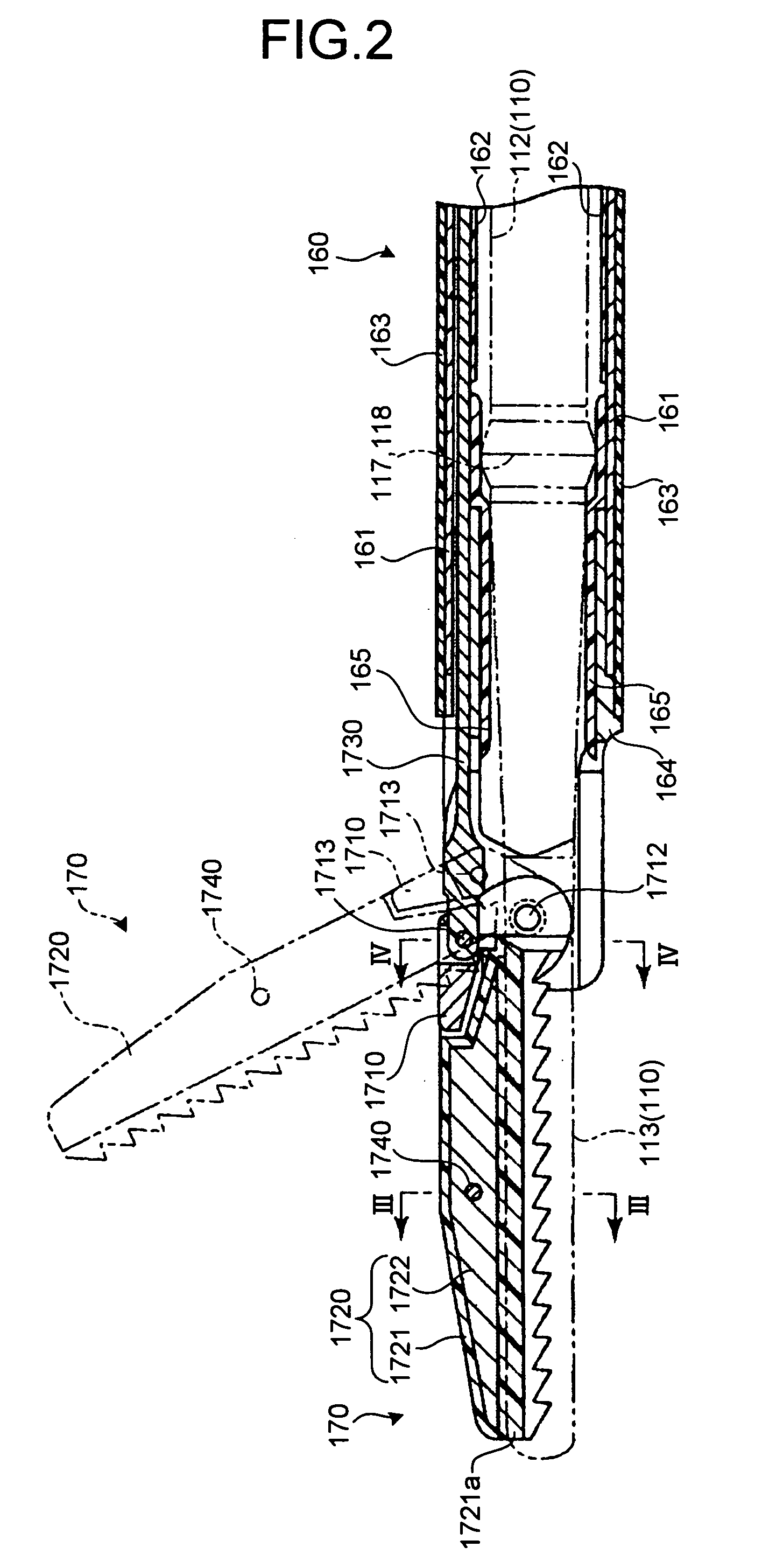 Ultrasonic treatment apparatus