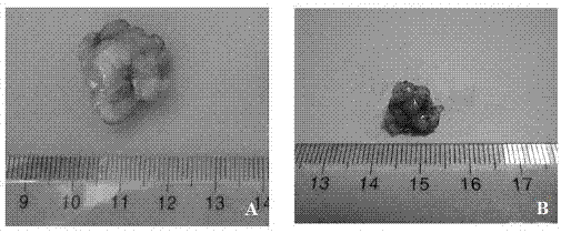 In-vivo tumor engineering human oophoroma tumor model established on basis of collagen aquogel