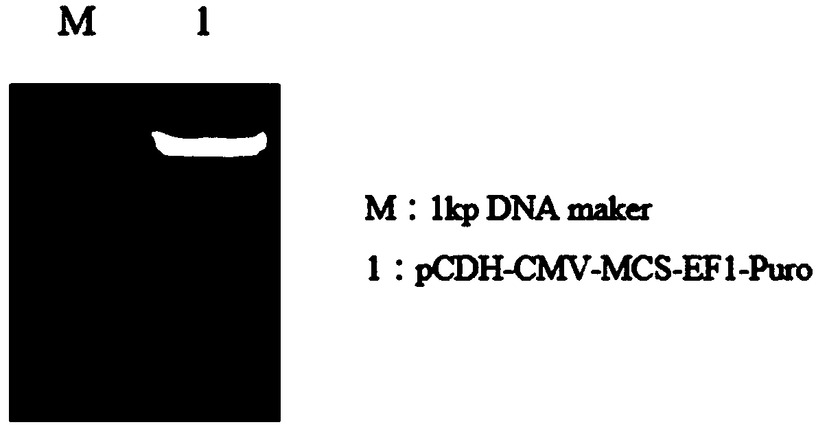 Dual-target CAR vector combining EpCAM and MSLN single-chain antibody, construction method of dual-target CAR vector and application of dual-target CAR vector in breast cancer