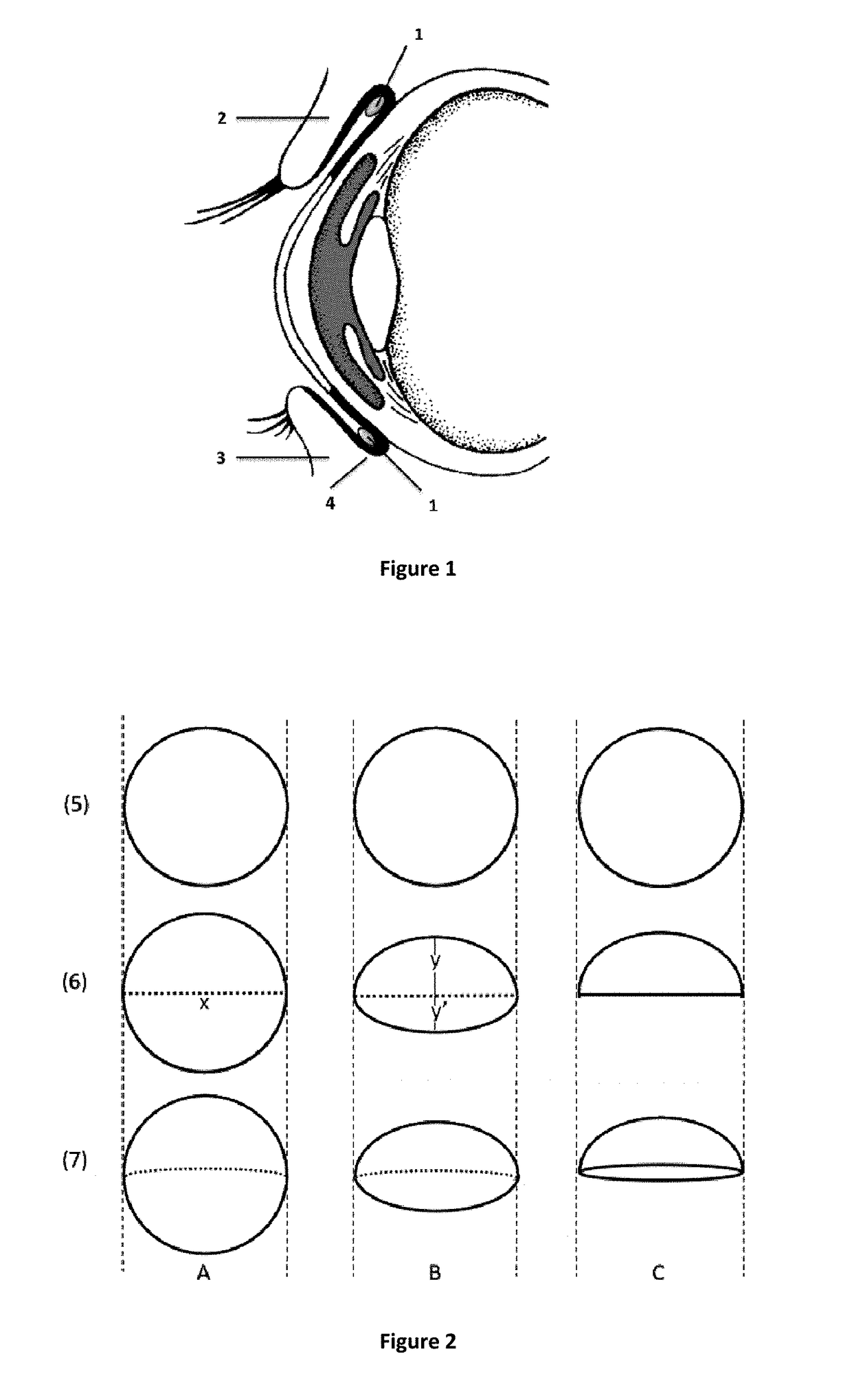 Non-invasive ocular drug delivery insert technology