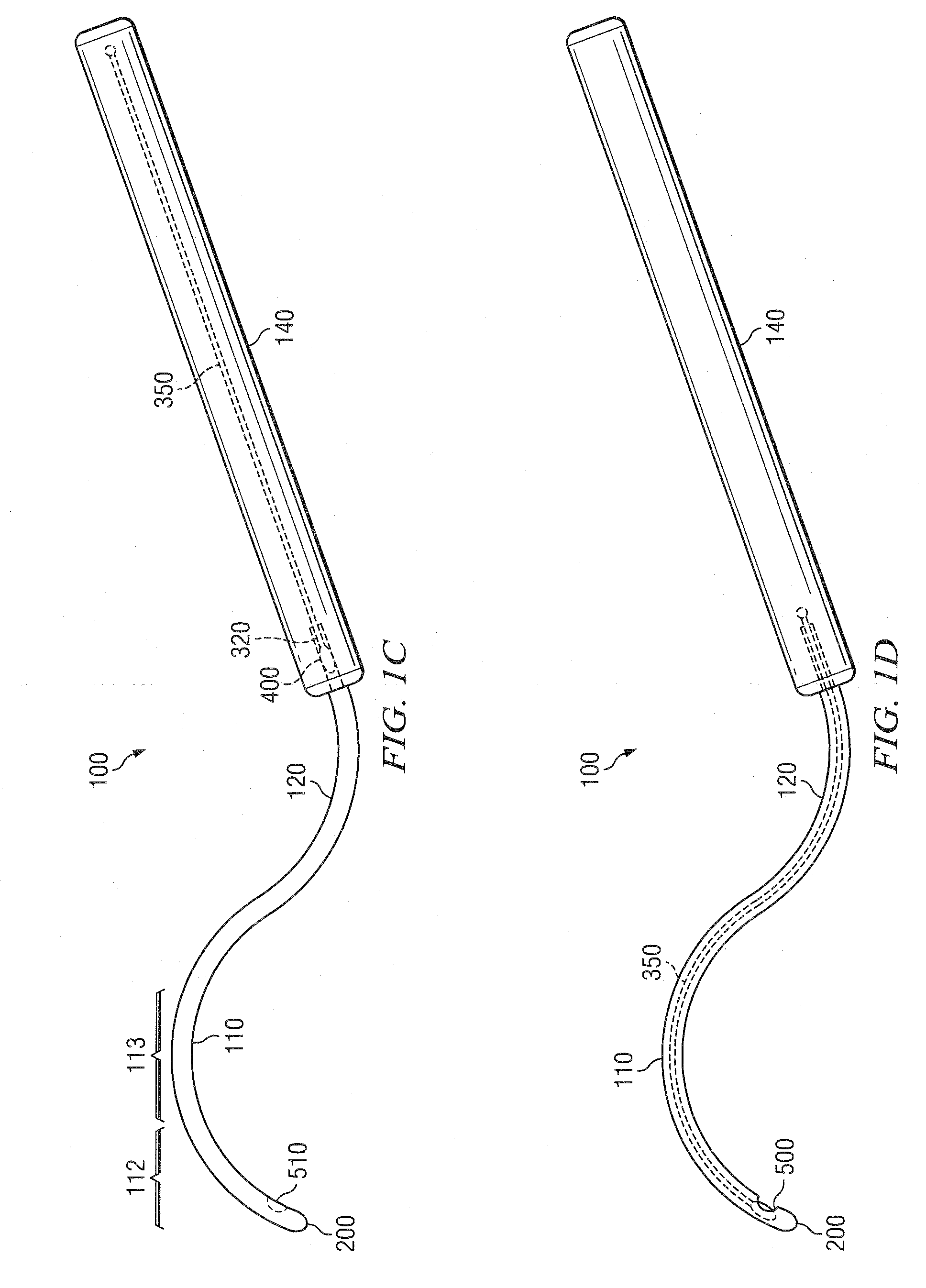 Methods And Devices For Minimally-Invasive Extraocular Delivery of Radiation To The Posterior Portion Of The Eye