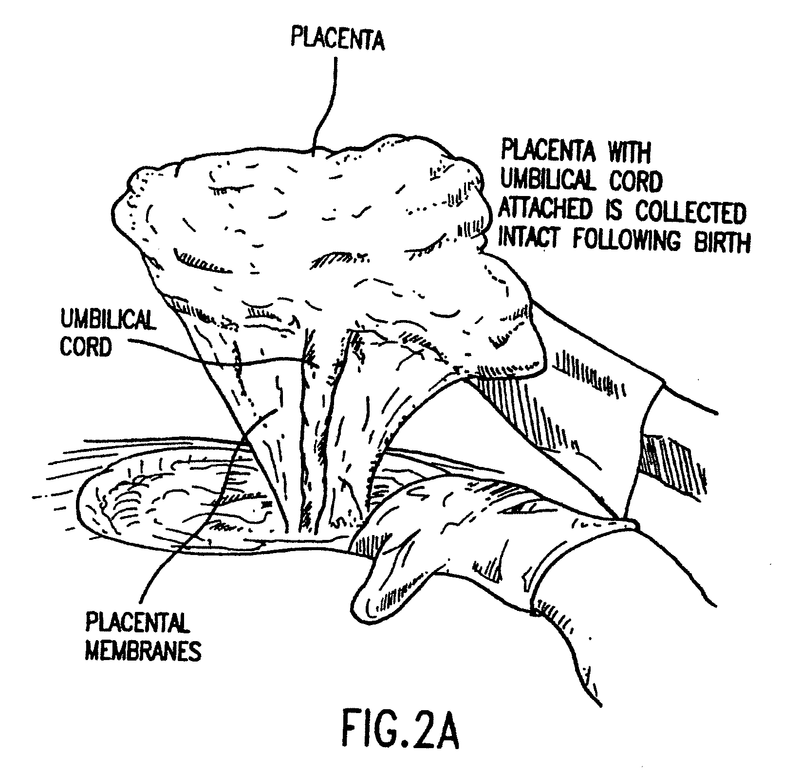 Composition for collecting and preserving placental stem cells and methods of using the composition