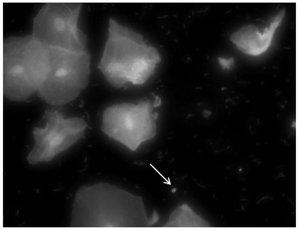 Multi-fluorescent staining solution as well as preparation method and use method thereof