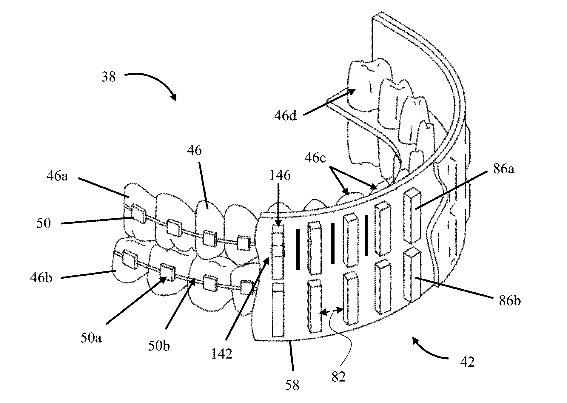 Apparatuses and Methods for Cancellation of Inhomogeneous Magnetic Fields Induced by Non-Biological Materials Within a Patient's Mouth During Magnetic Resonance Imaging