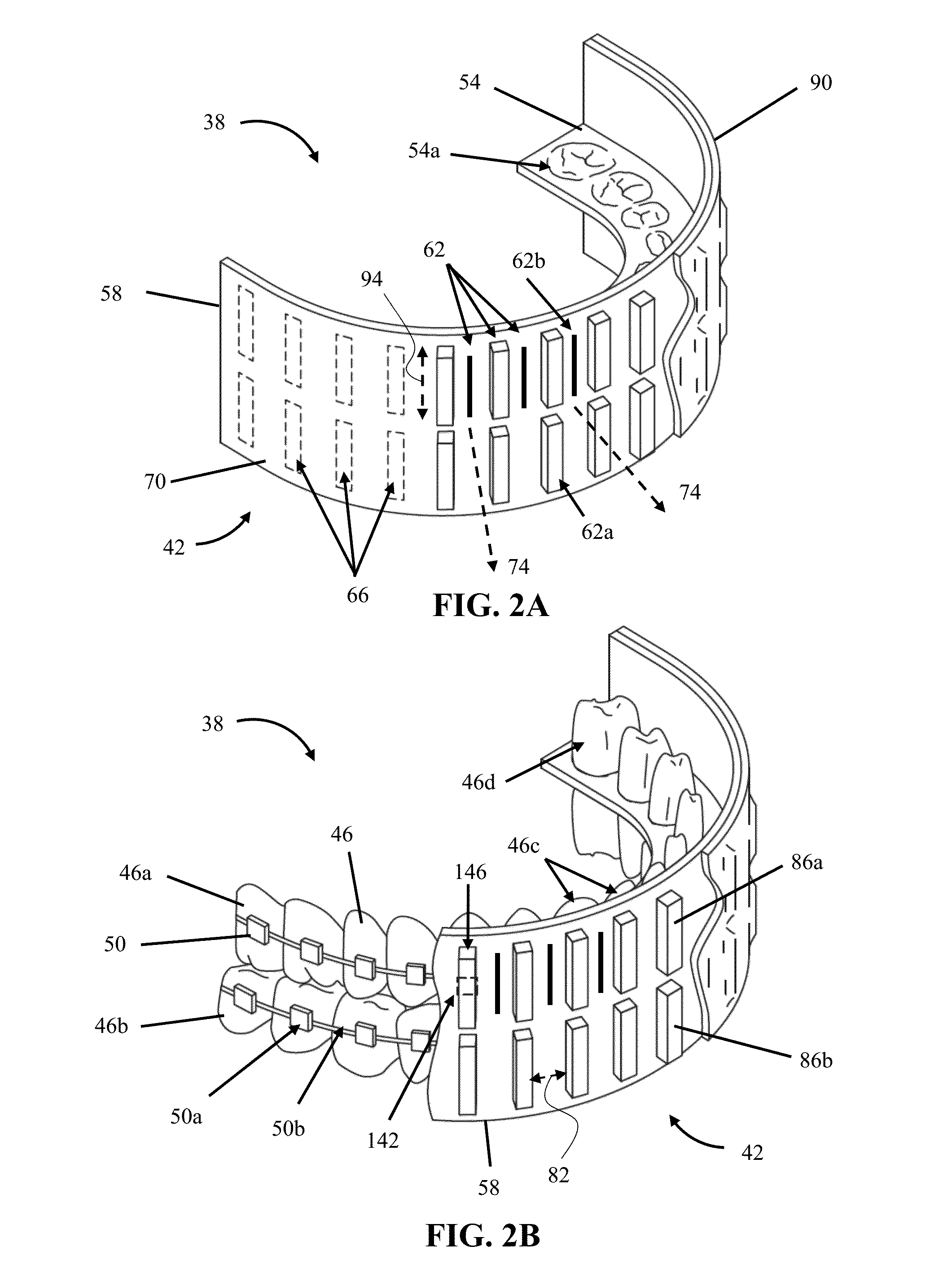 Apparatuses and Methods for Cancellation of Inhomogeneous Magnetic Fields Induced by Non-Biological Materials Within a Patient's Mouth During Magnetic Resonance Imaging