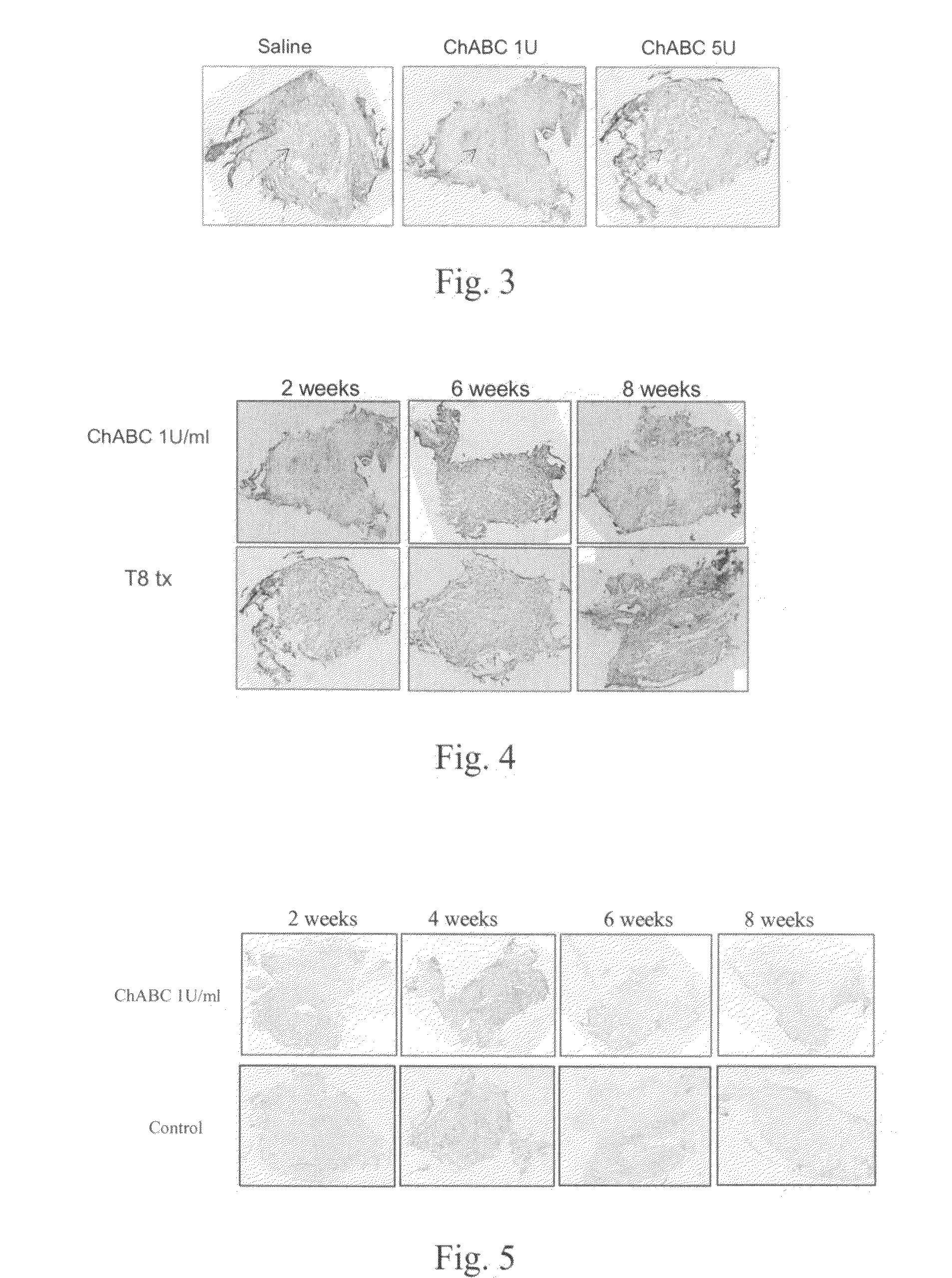 Method for promoting axonal re-growth and behavior recovery in spinal cord injury