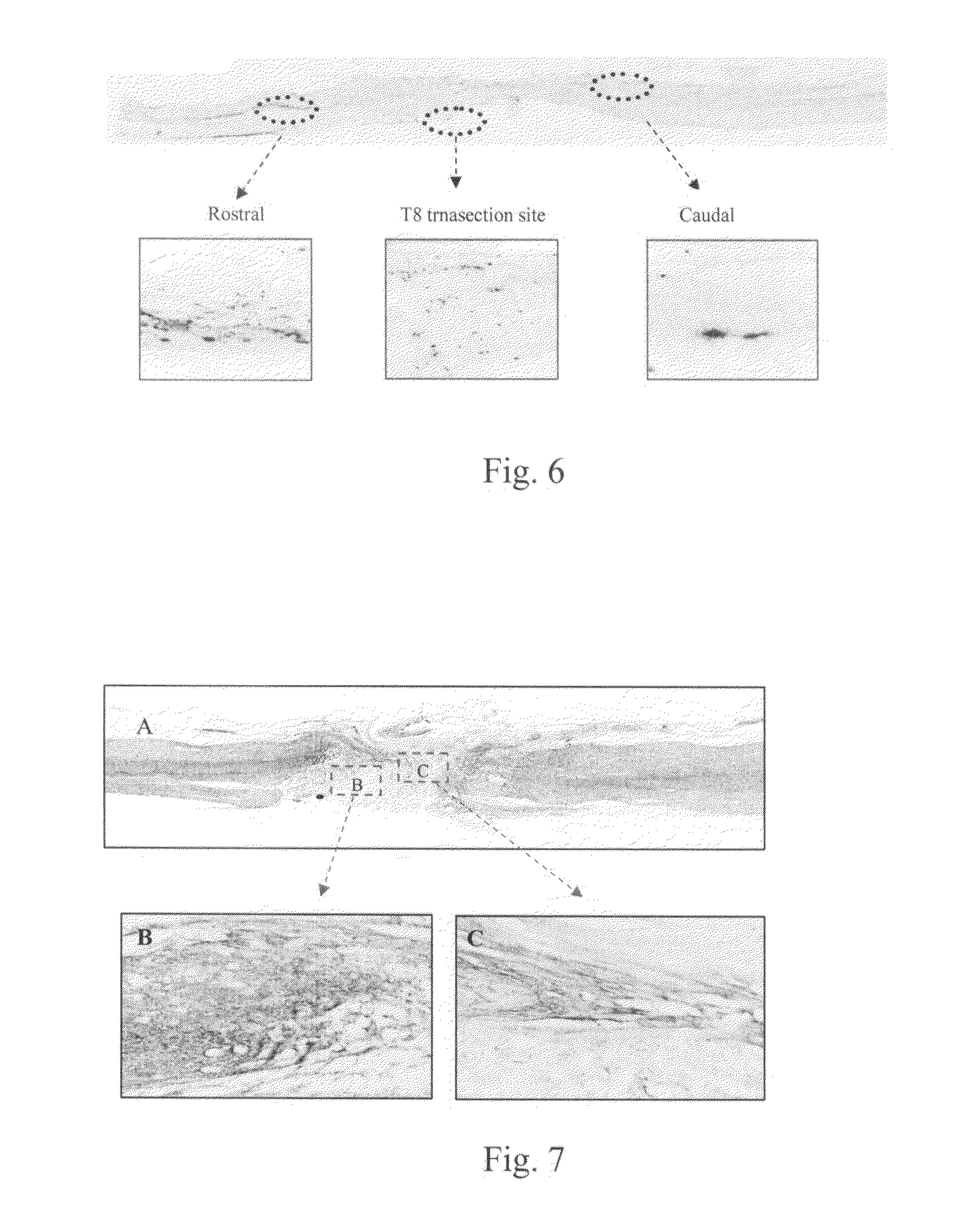 Method for promoting axonal re-growth and behavior recovery in spinal cord injury