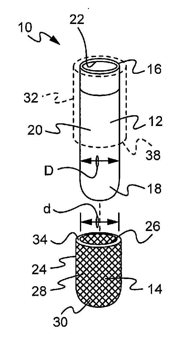 Expandable Bone Implant