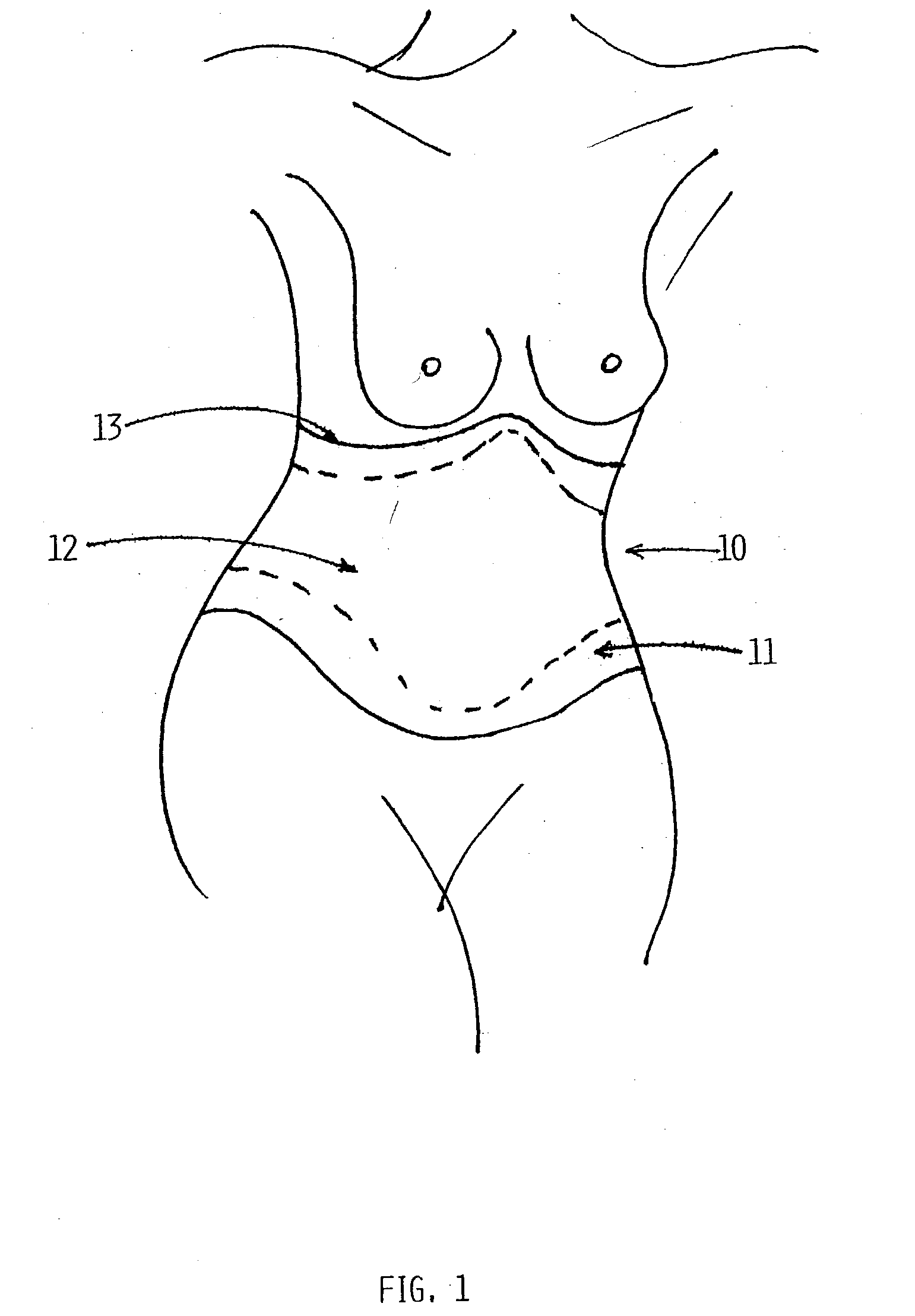 Anatomical compression pad system