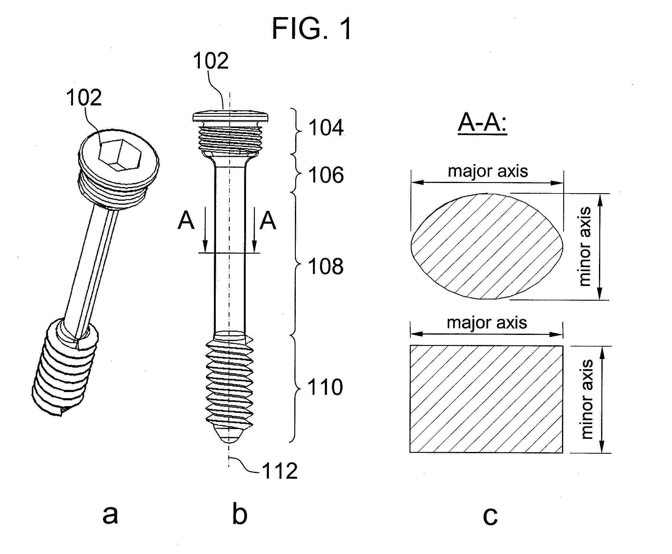 Rotationally asymmetric bone screw