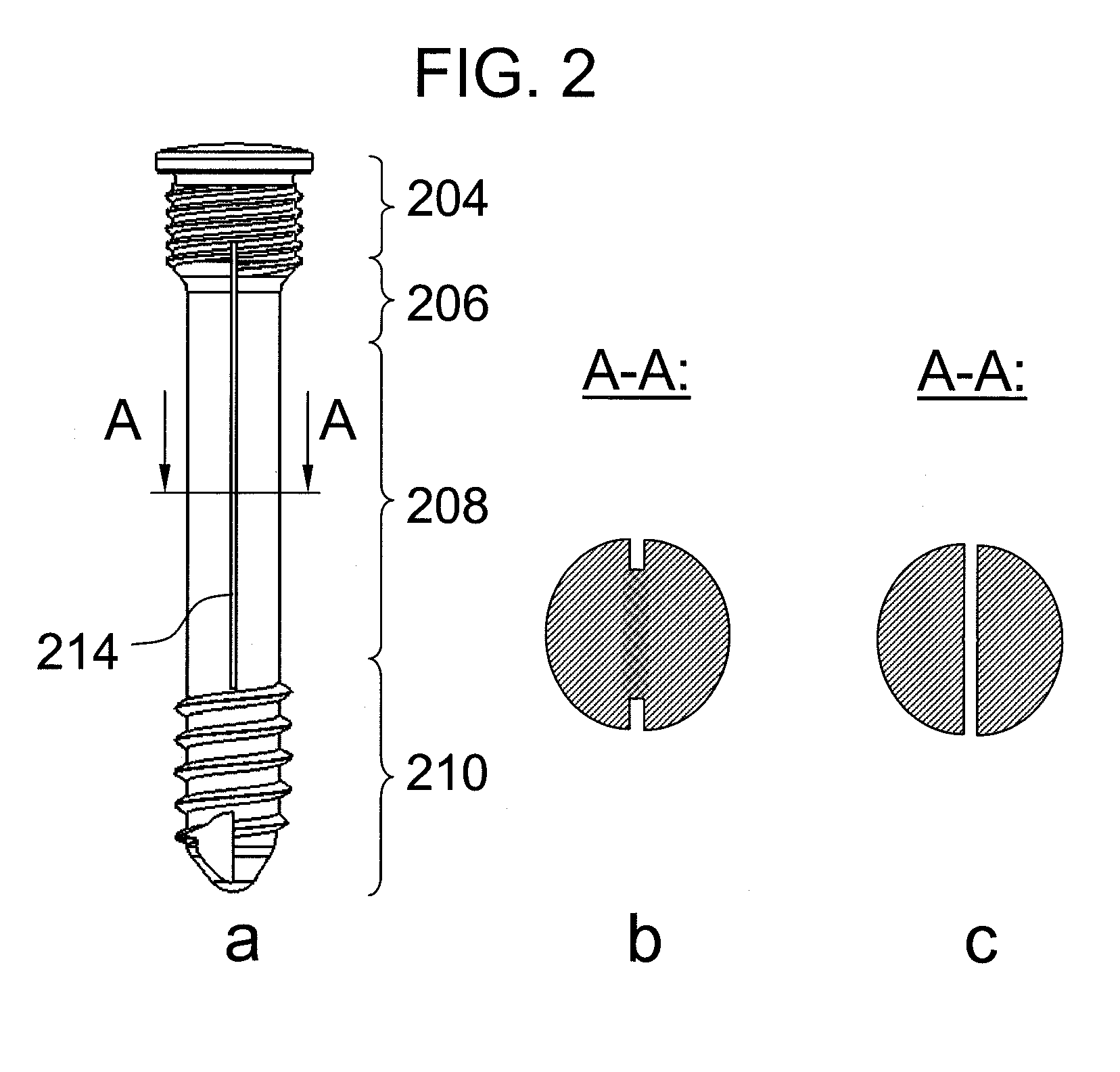 Rotationally asymmetric bone screw