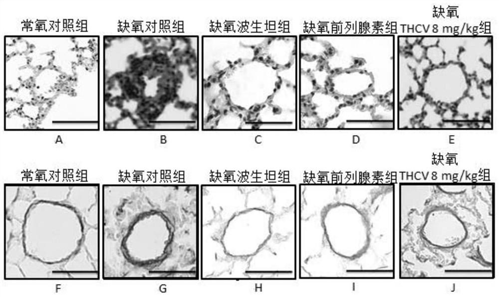 Application of tetrahydrocannabidivarin in preparation of medicine for treating pulmonary arterial hypertension and medicine composition containing tetrahydrocannabidivarin