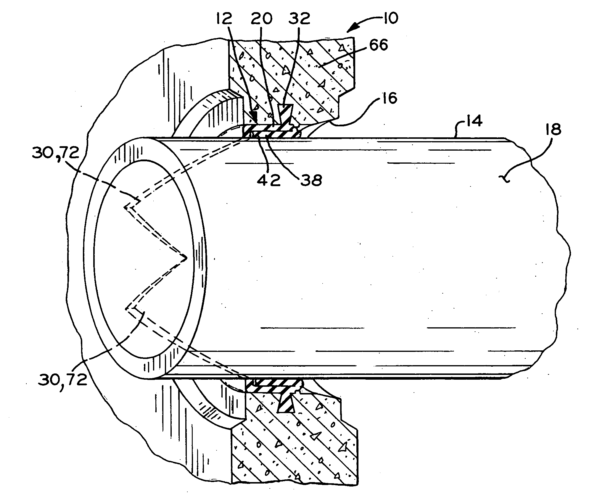 Pipe joint seal with closed end face