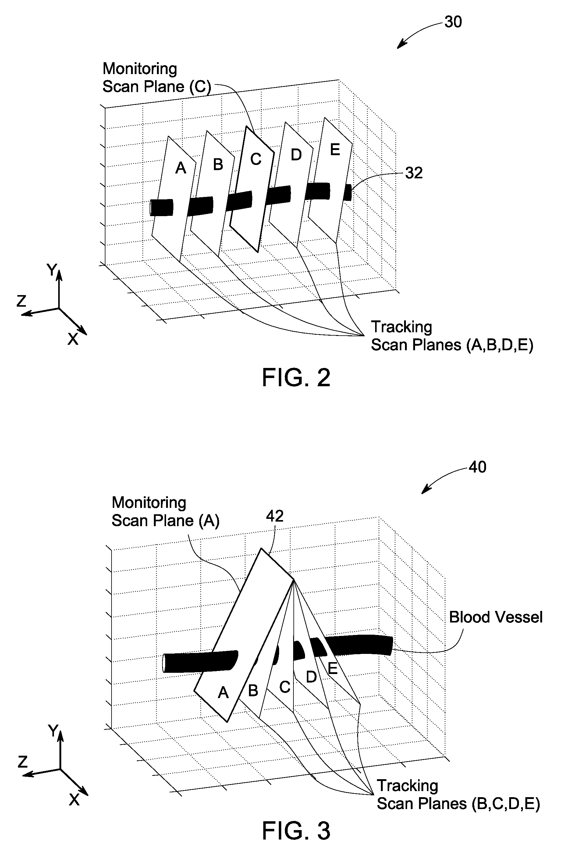 Method and system for non-invasive monitoring of patient parameters