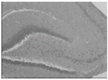 Identification method for urine metabolism marker based on alzheimer disease