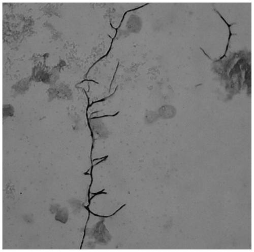 Streptomyces lydicus and application thereof to prevention and treatment of fire blight