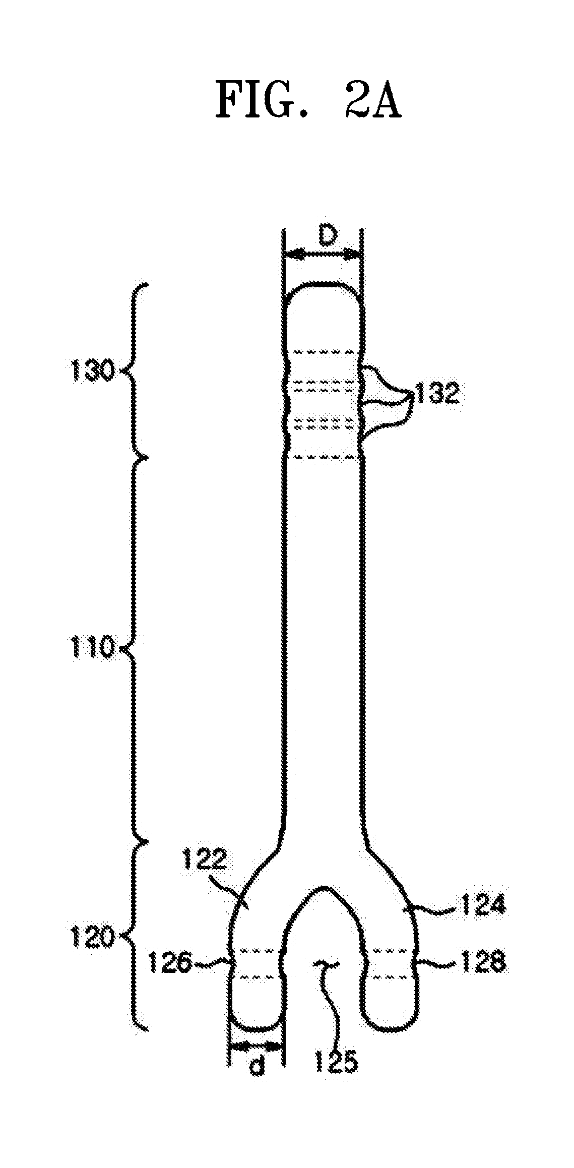 Prosthesis for nose surgery