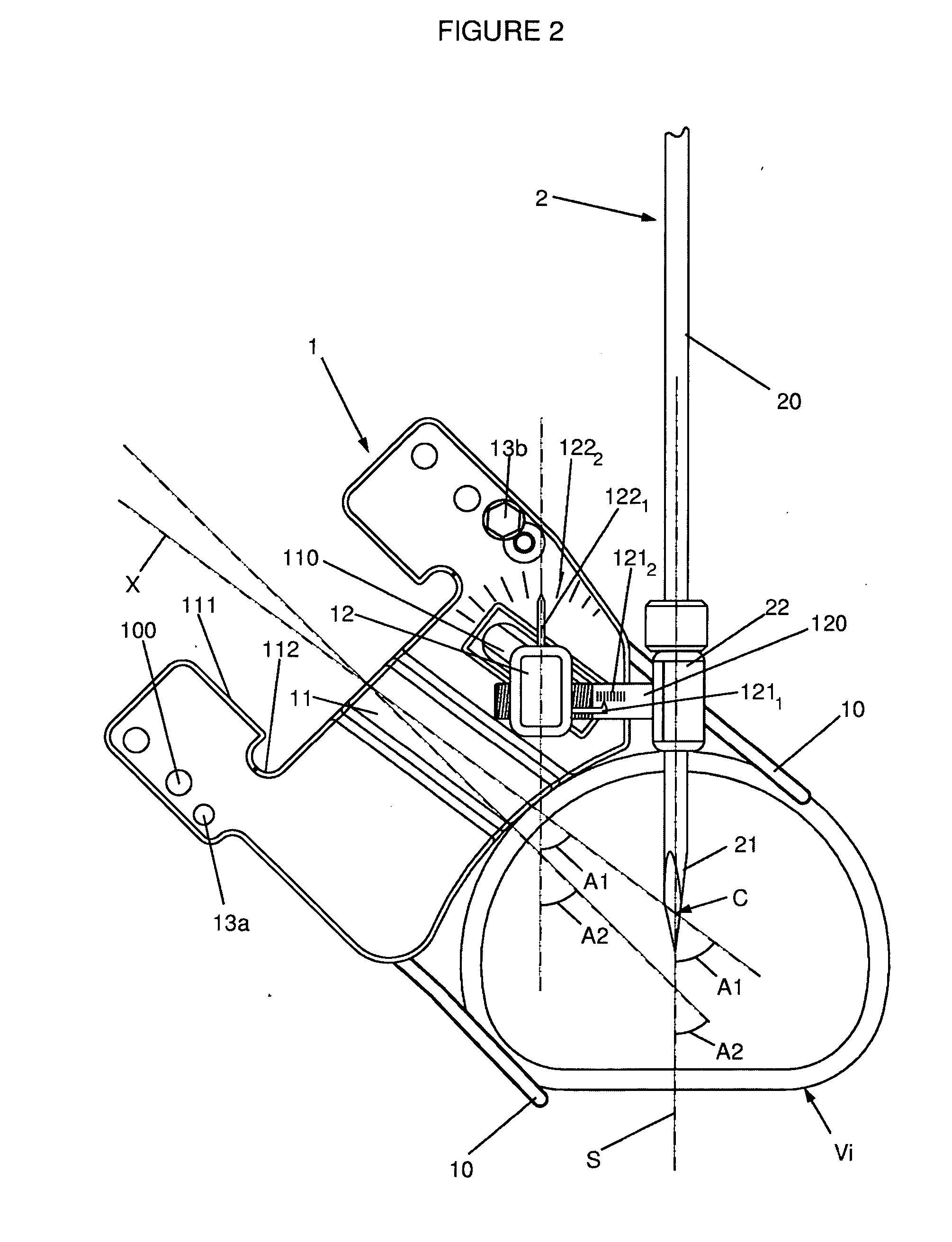 Instrumentation and methods for inserting an intervertebral disc prosthesis