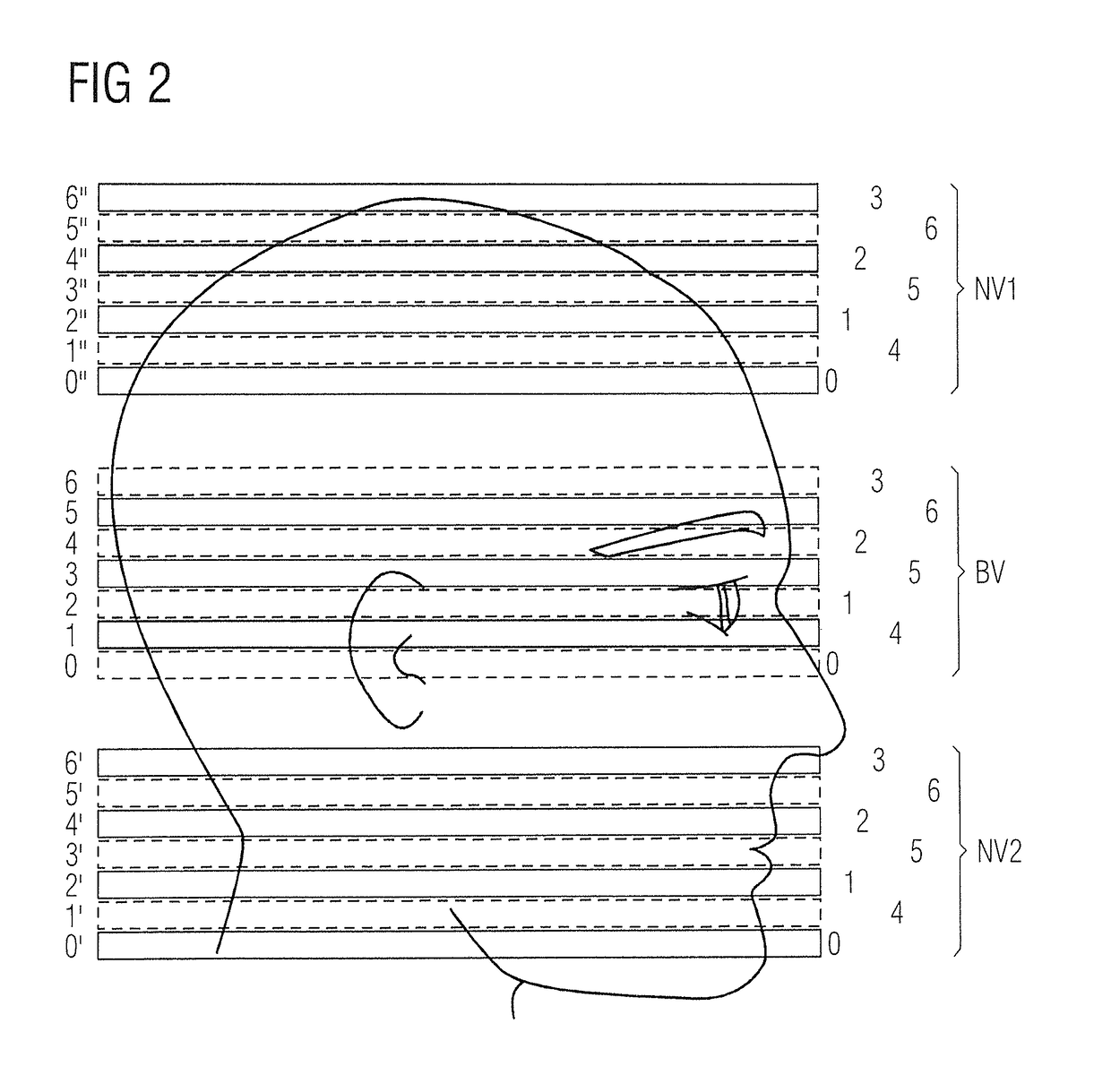 Magnetic resonance imaging method and apparatus with simultaneous image acquisition of multiple sub-volumes with synchronous acquisition of navigators