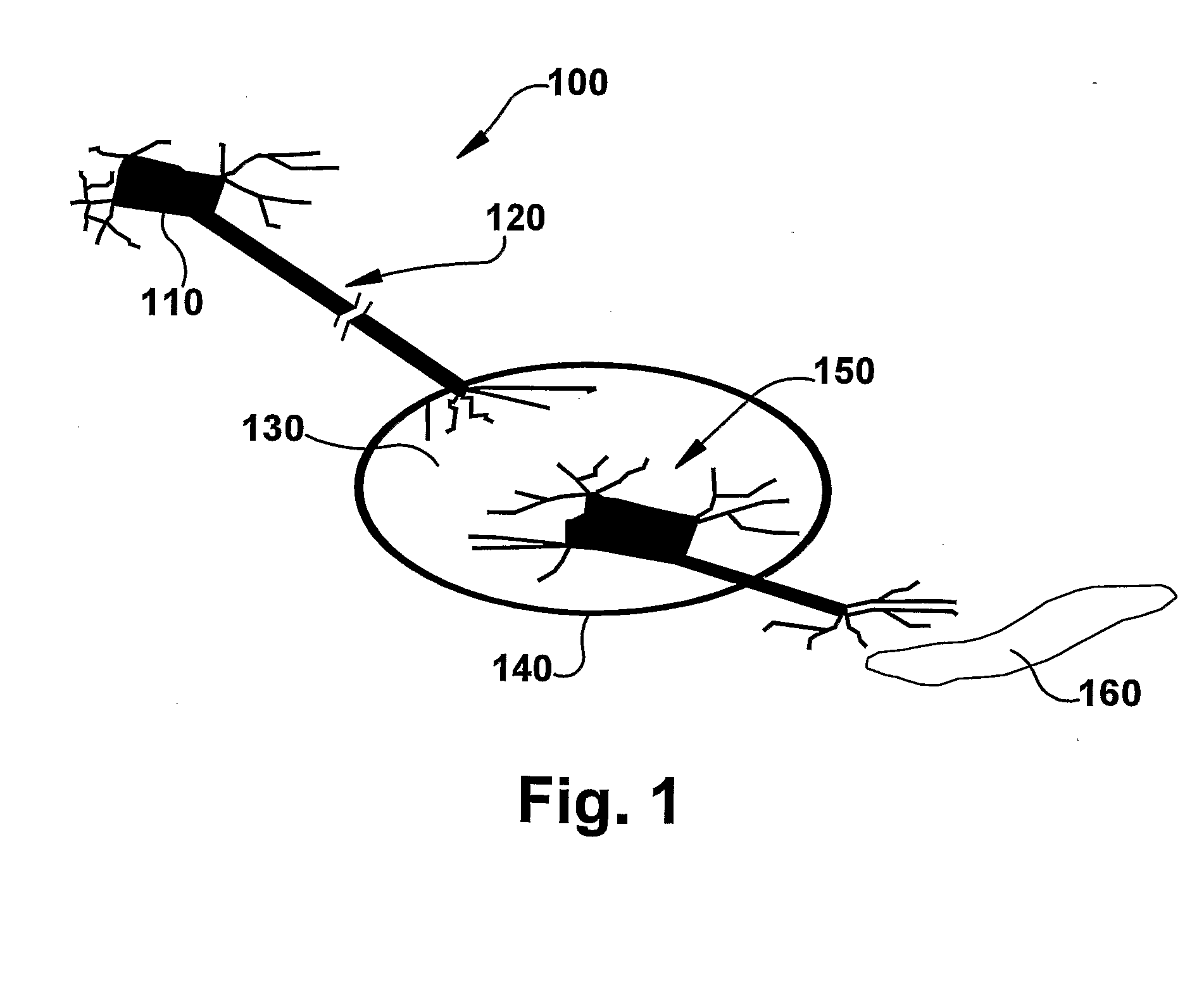 System and Method for Achieving Regular Slow Ventricular Rhythm in Response to Atrial Fibrillation