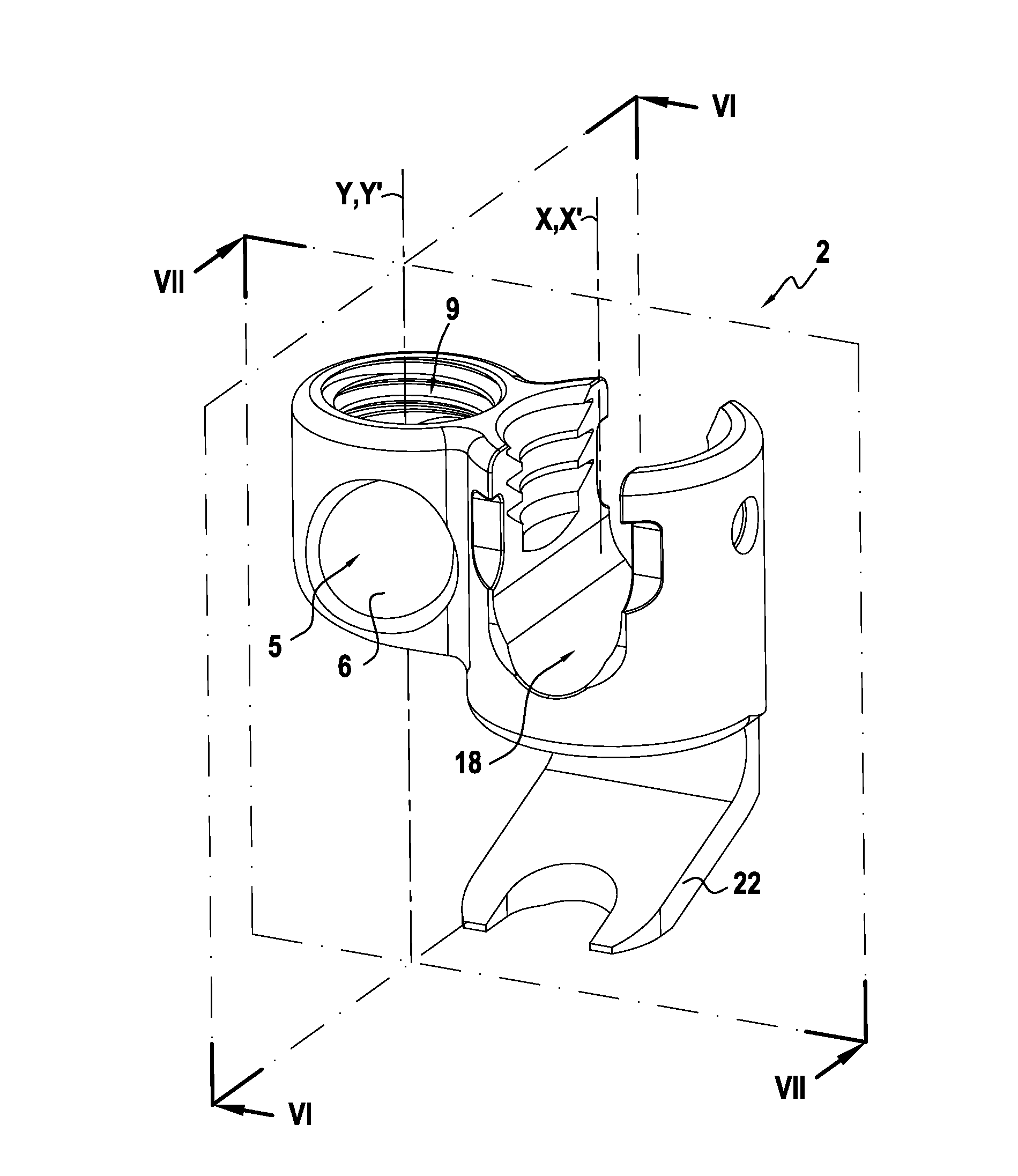 Orthopaedic device and methods for its pre-assembly and assembly