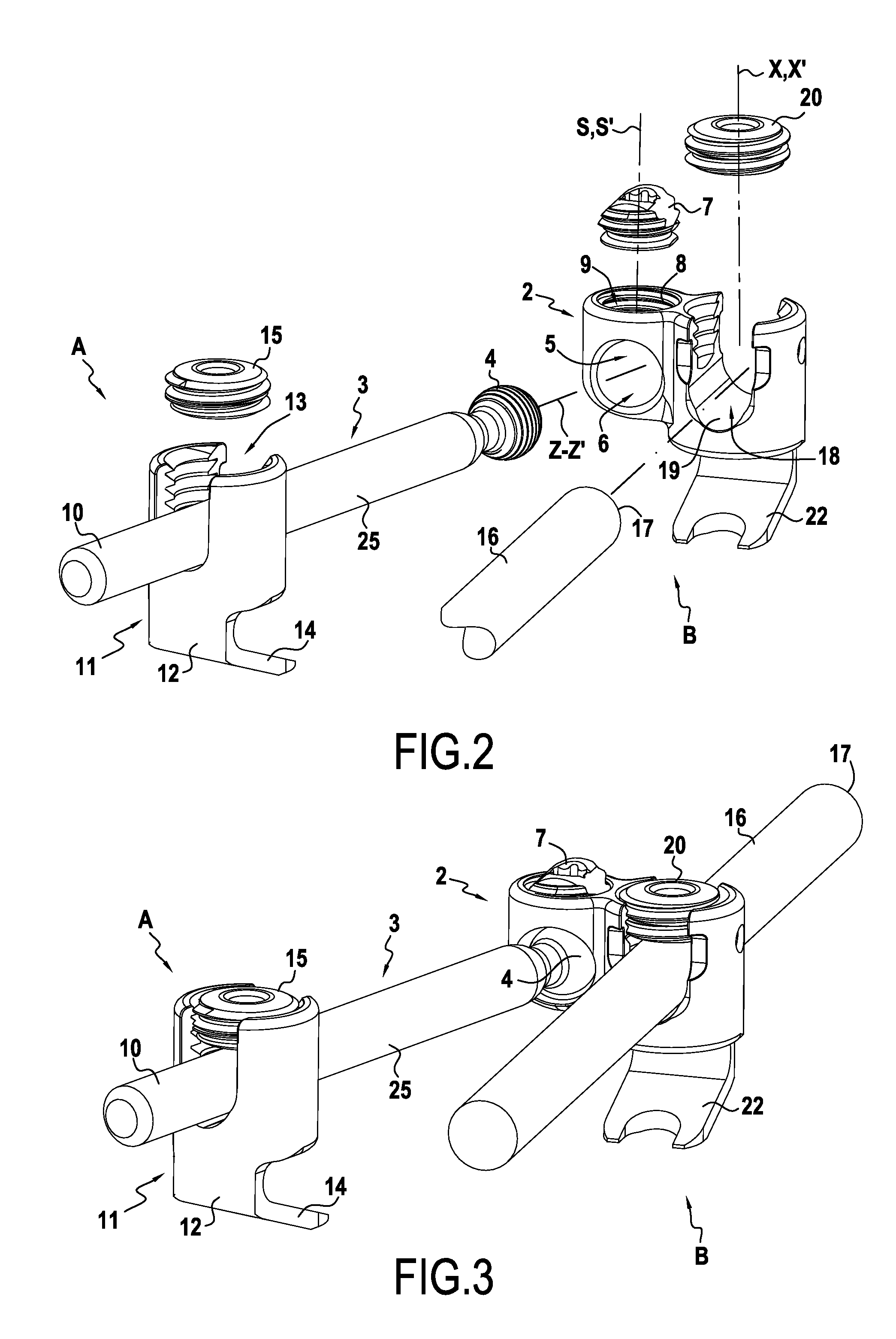 Orthopaedic device and methods for its pre-assembly and assembly